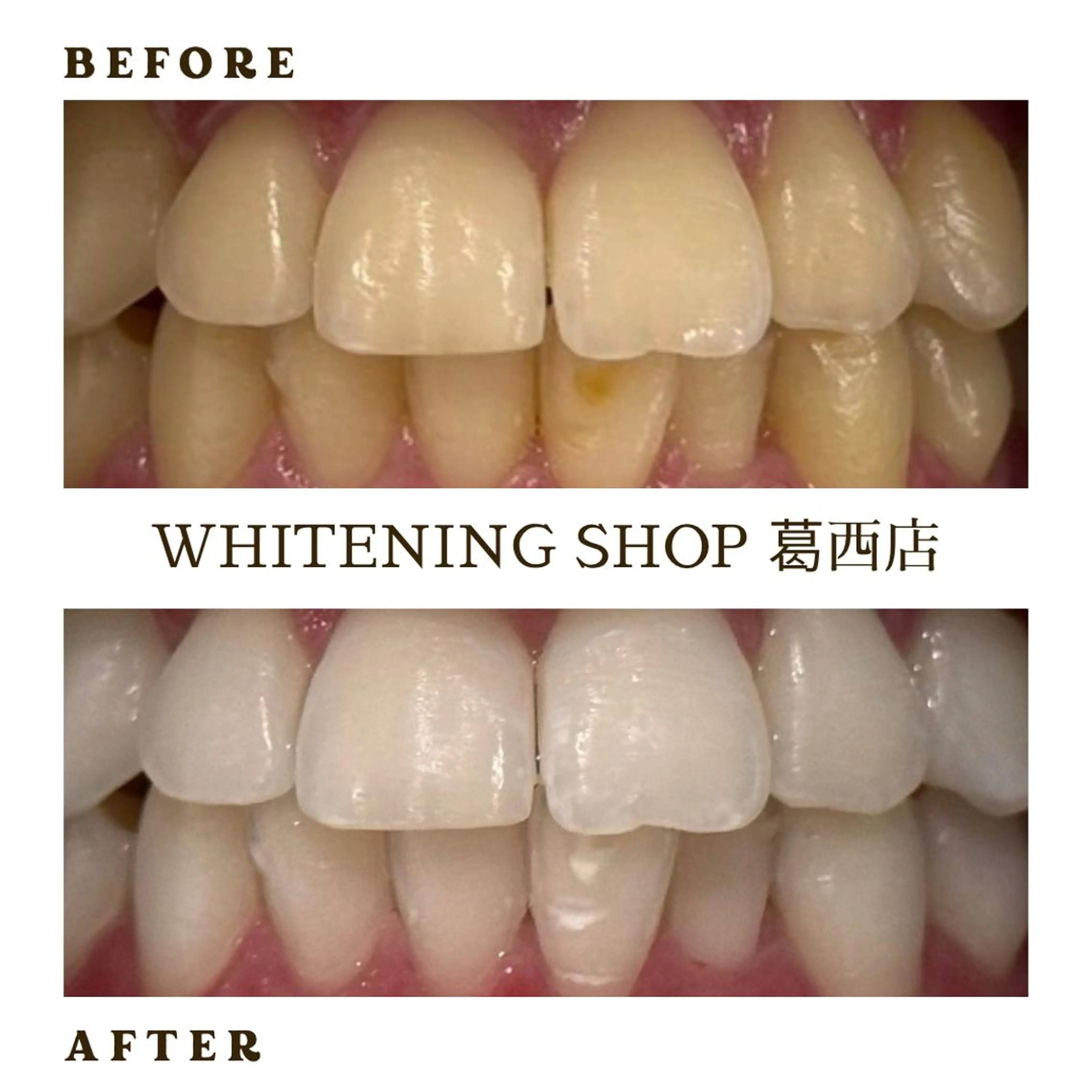 メンズ その他 ホワイトニング ショップ葛西店のその他イメージ