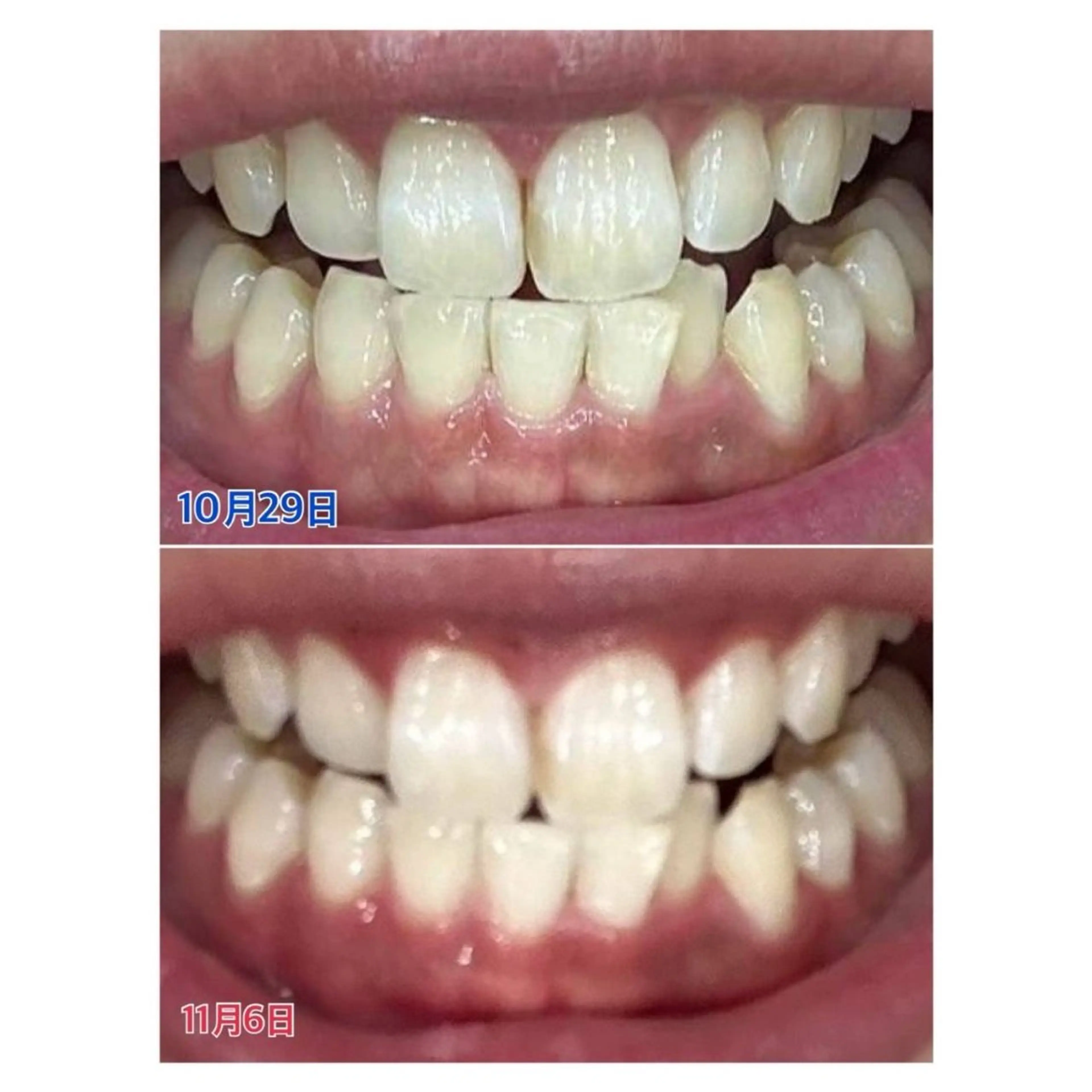 MBEAUTYSALON 千葉店・京成大久保所属・Melty 輝のその他イメージ