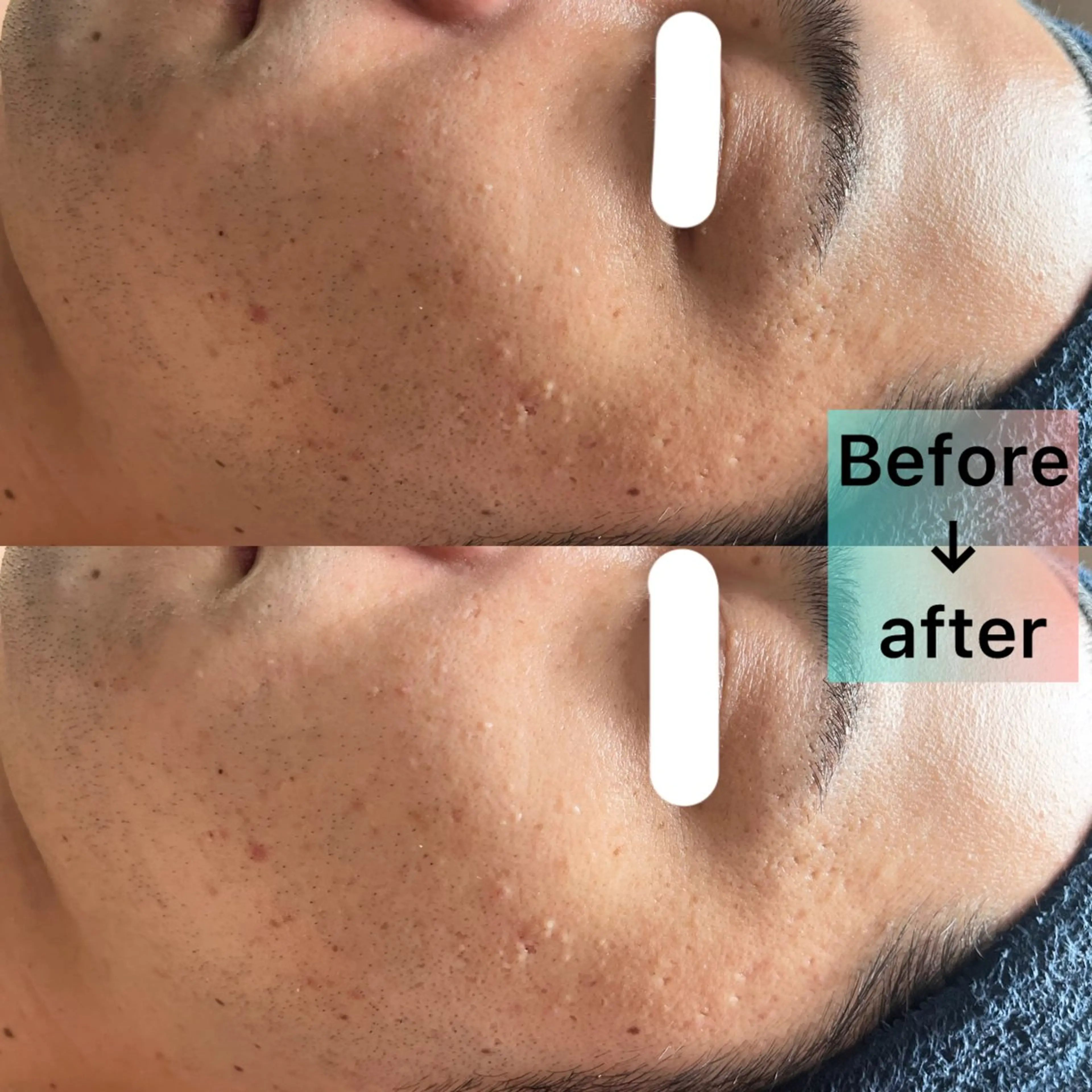 LaBeIIevie ラベルヴィのマツエク・マツパデザイン