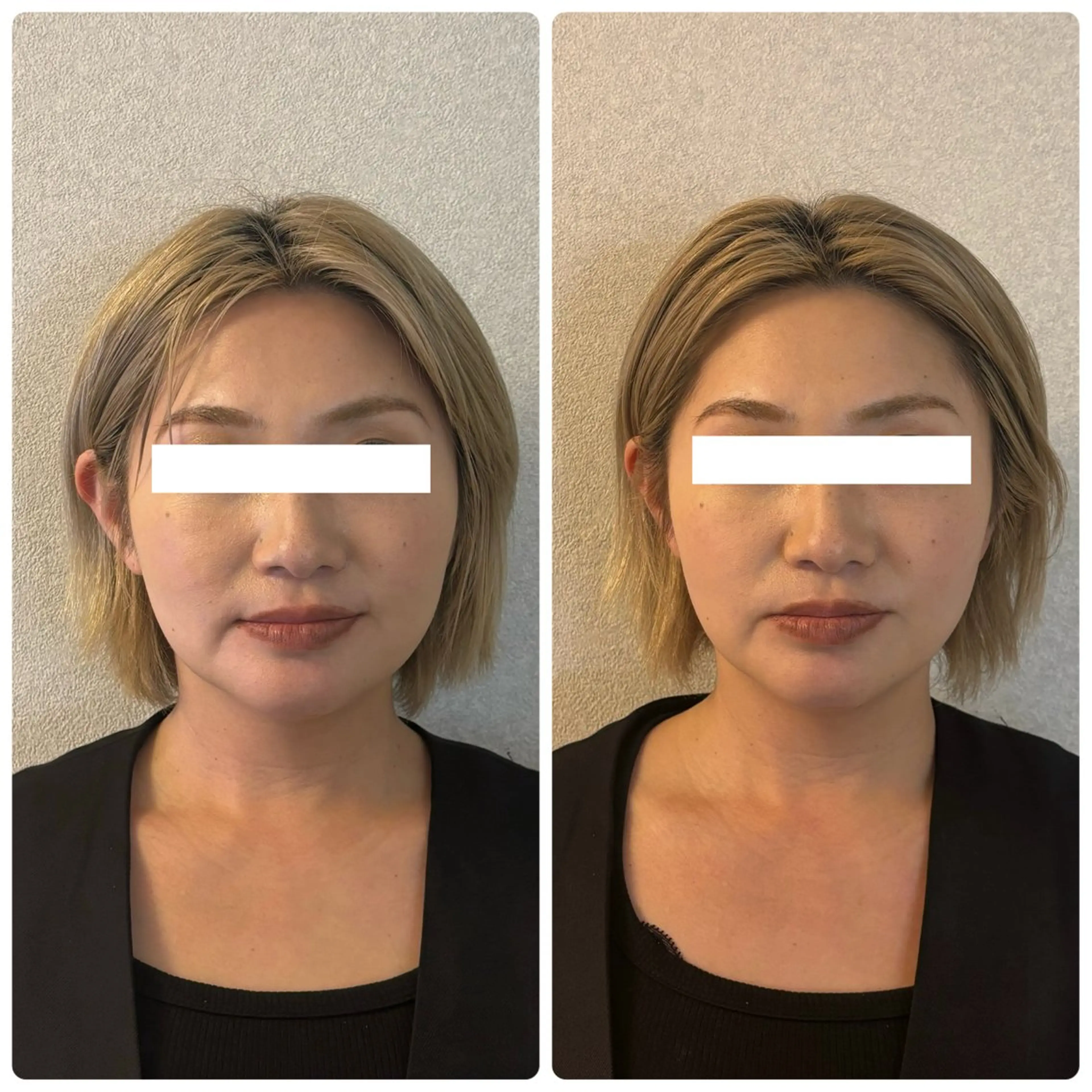 片山けいこ｜ 美人顔創りの専門家のエステ・リラクイメージ