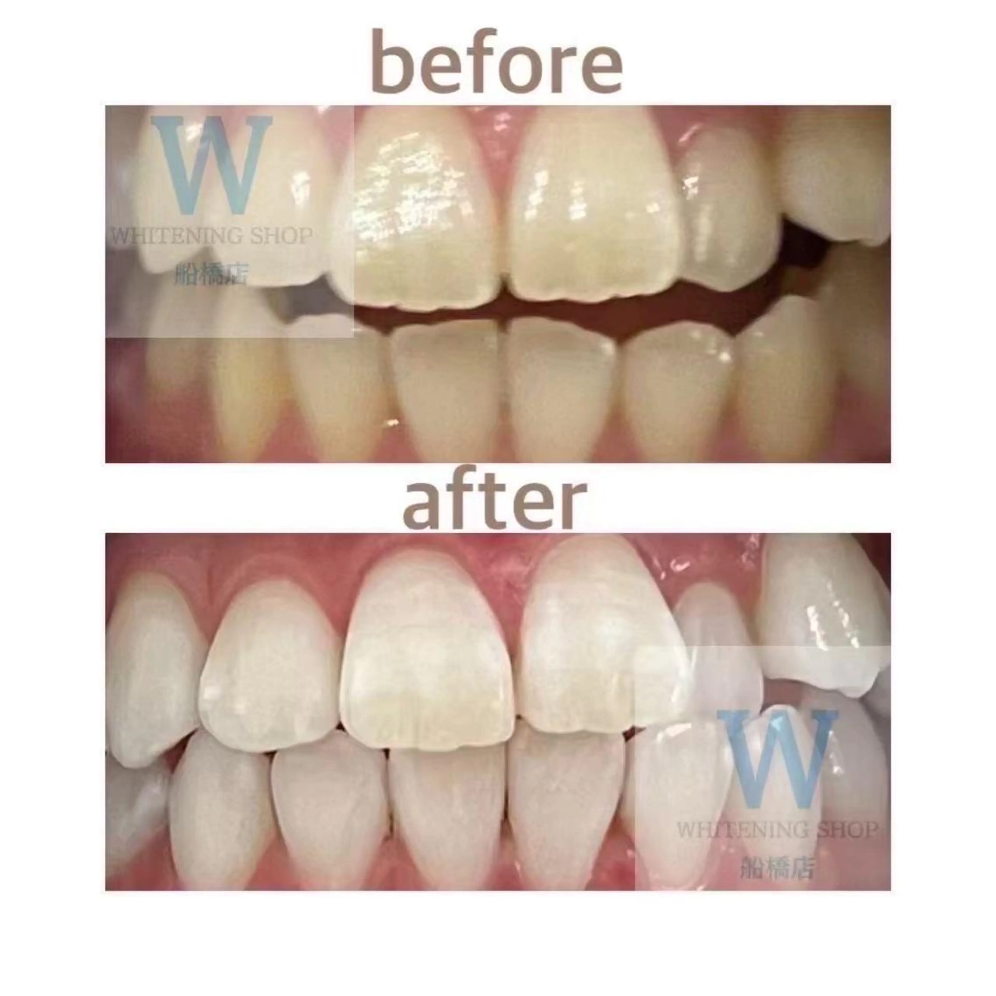 ホワイトニング ショップ船橋店🦷のエステ・リラクイメージ