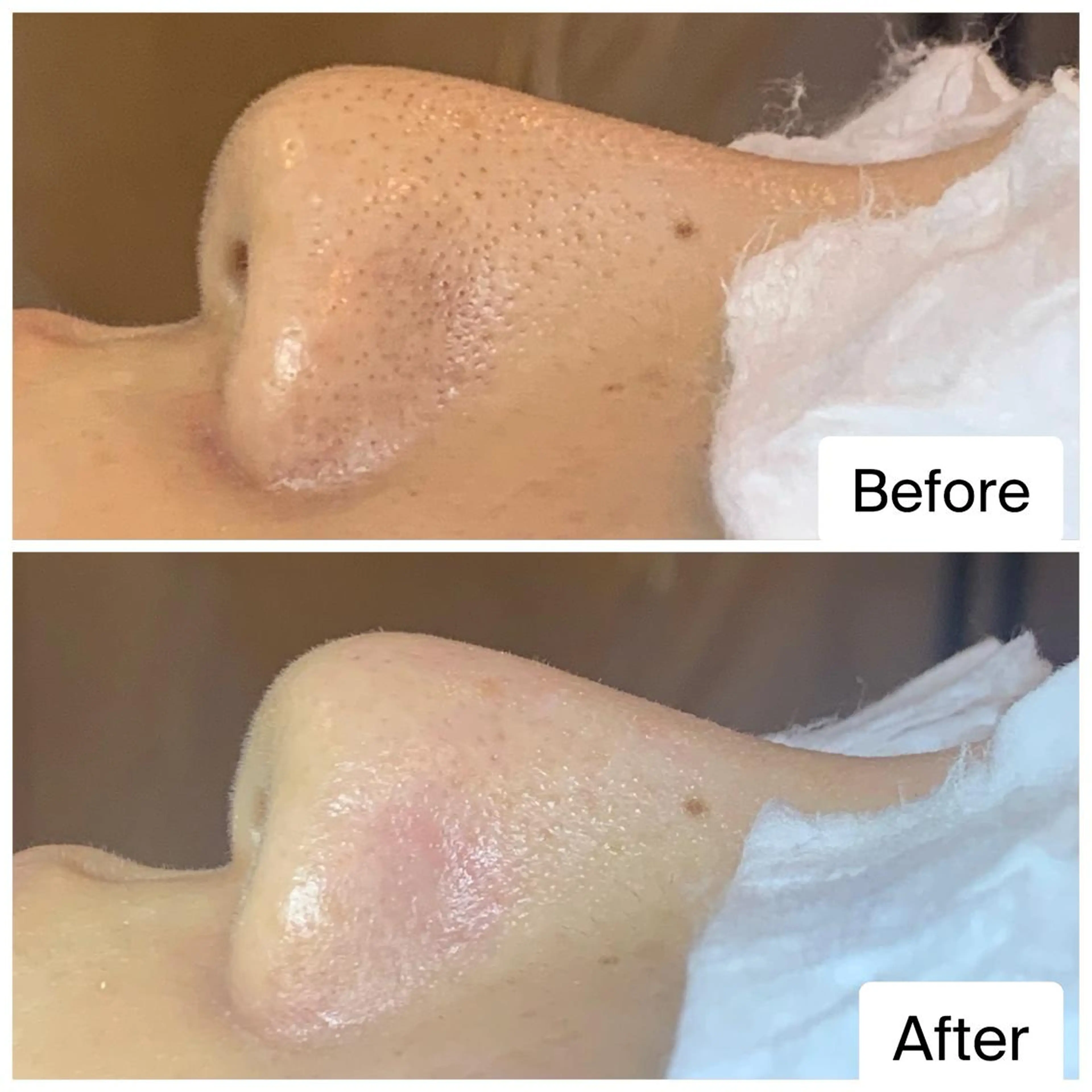 エステ ielu〜毛穴ケア ハーブピーリングのエステ・リラクイメージ