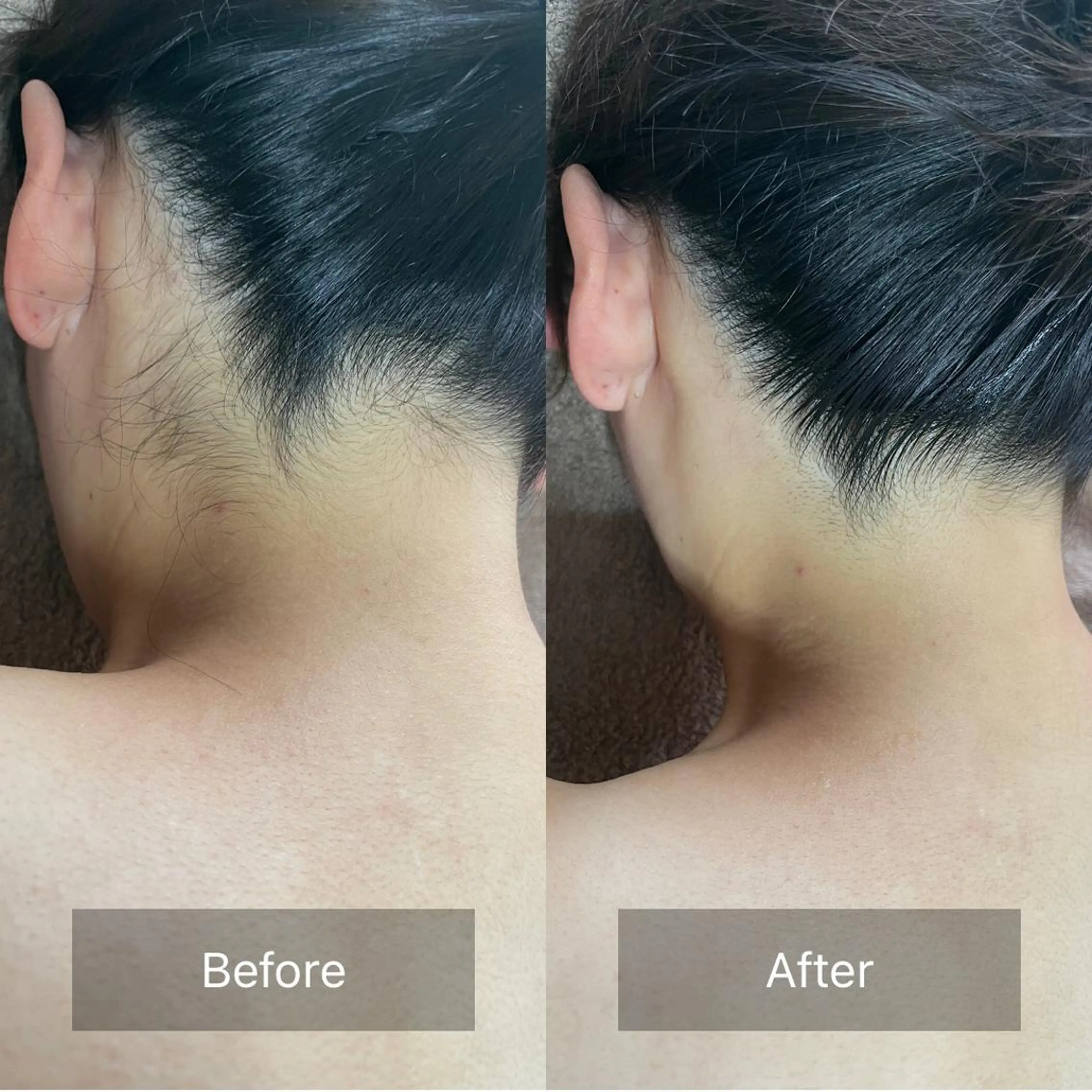 脱毛 ボディーメイクサロン Healingのエステ・リラクイメージ