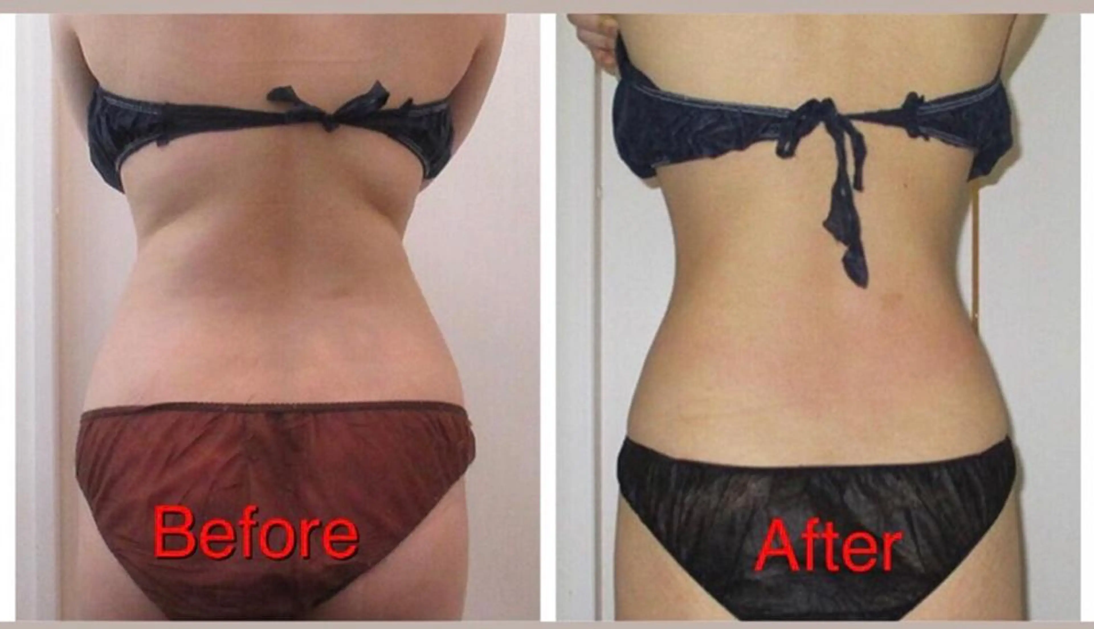 全身痩身✨ キレイサローネ表参道のエステ・リラクイメージ