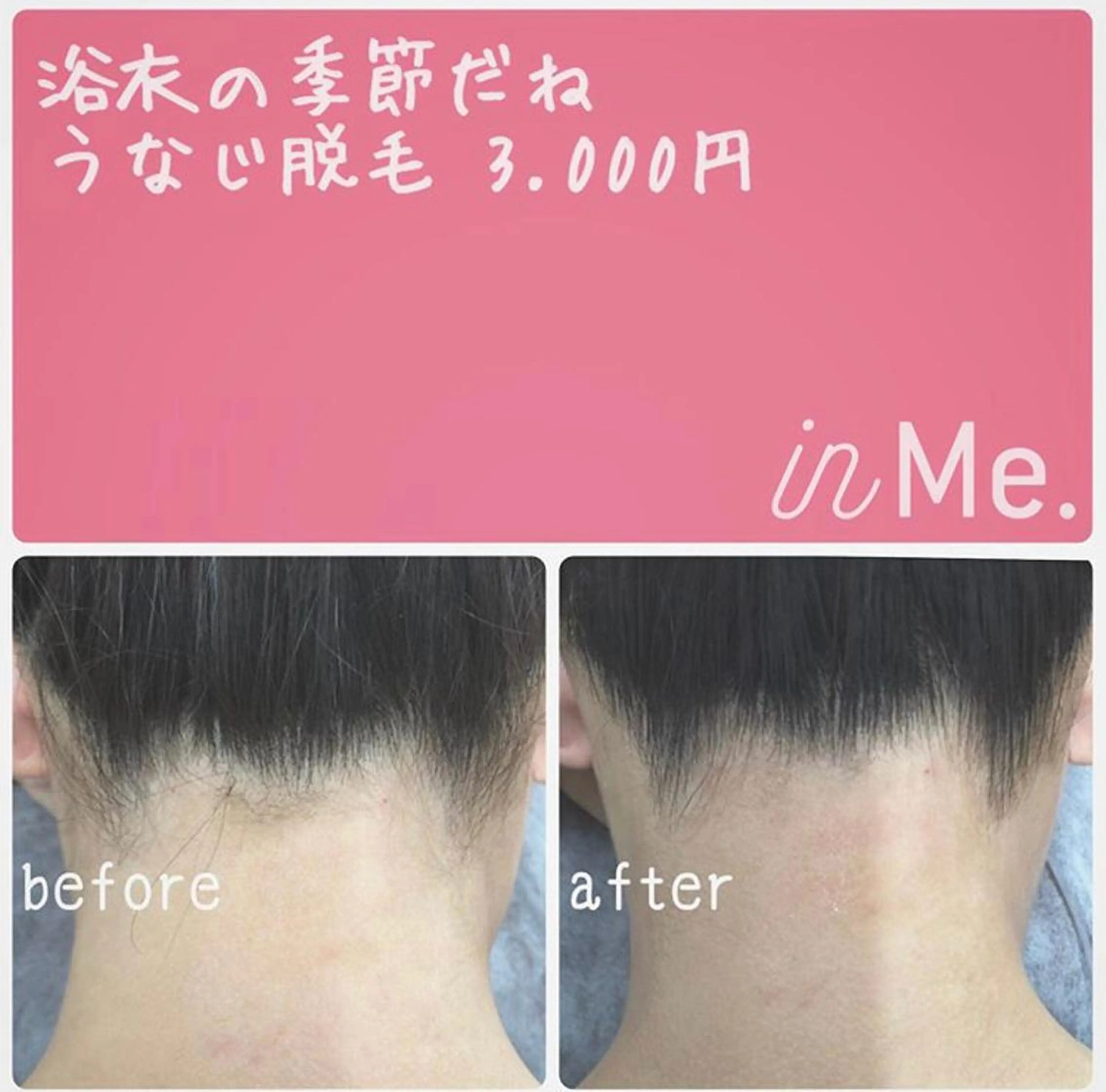 in Me.(インミー)所属・◆つど払い脱毛◆ in Me.インミーのエステ・リラクイメージ