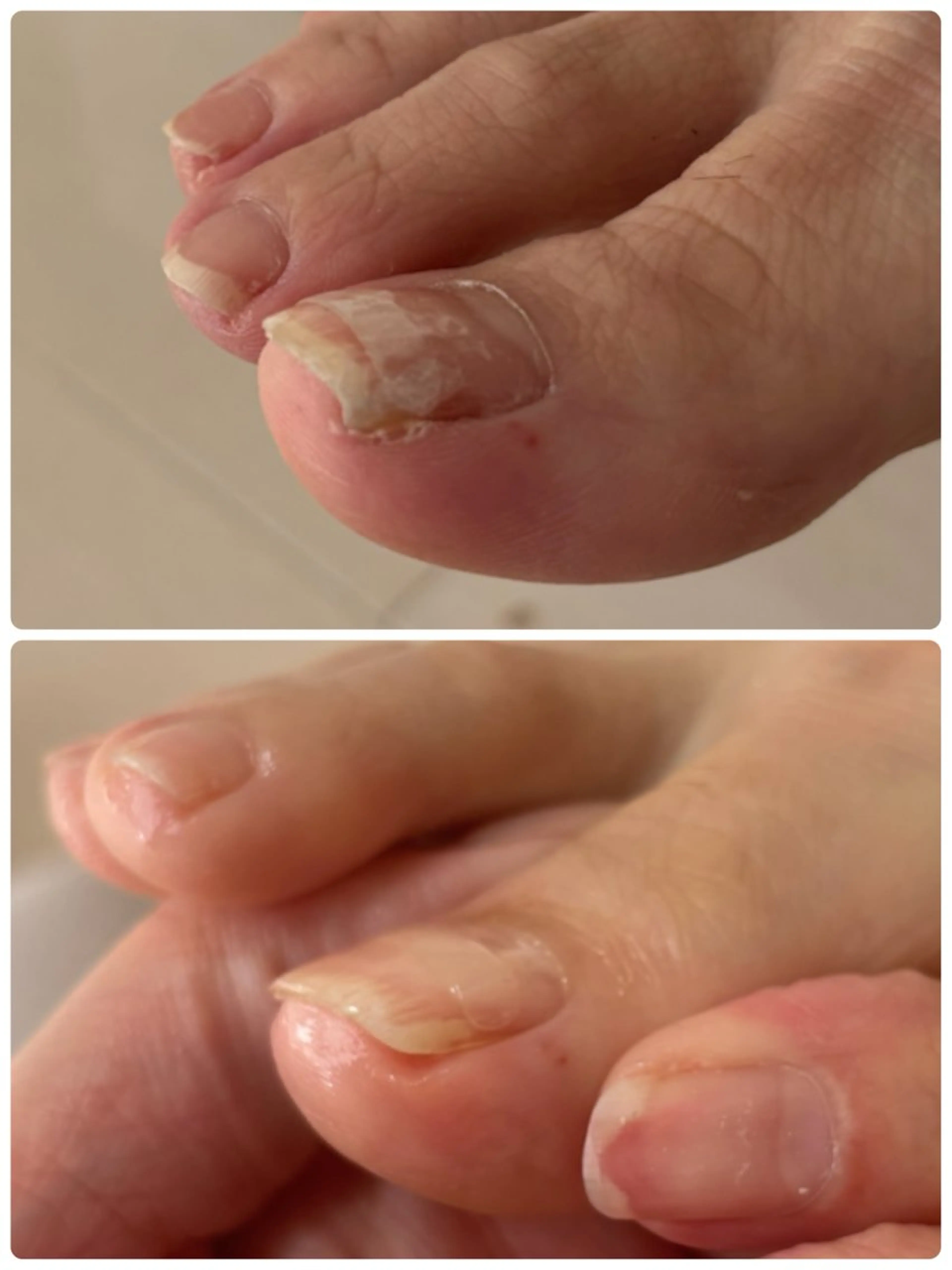 ネイル Alo.nail アロ•ネイルのネイルデザイン