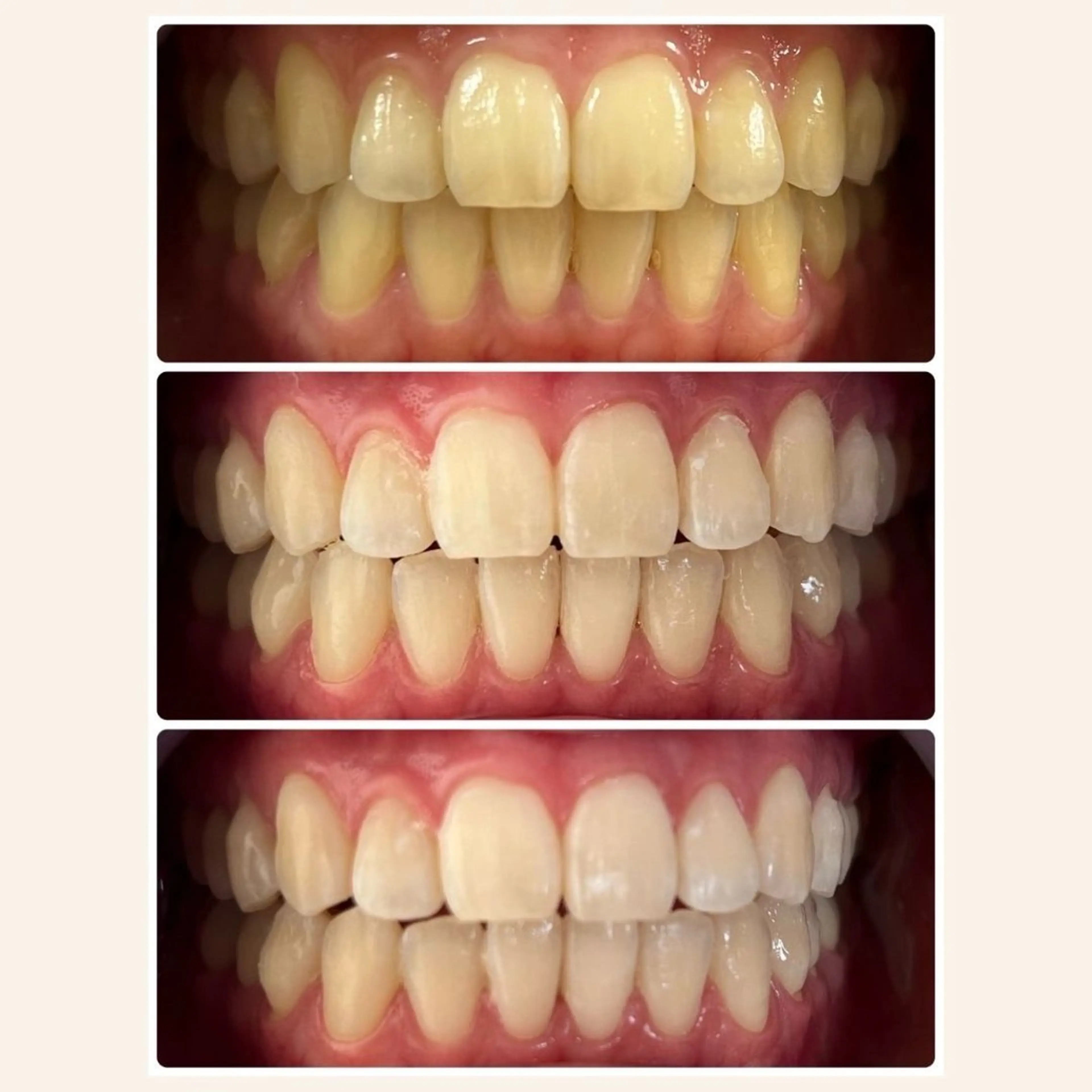 藤井 ののみのエステ・リラクイメージ