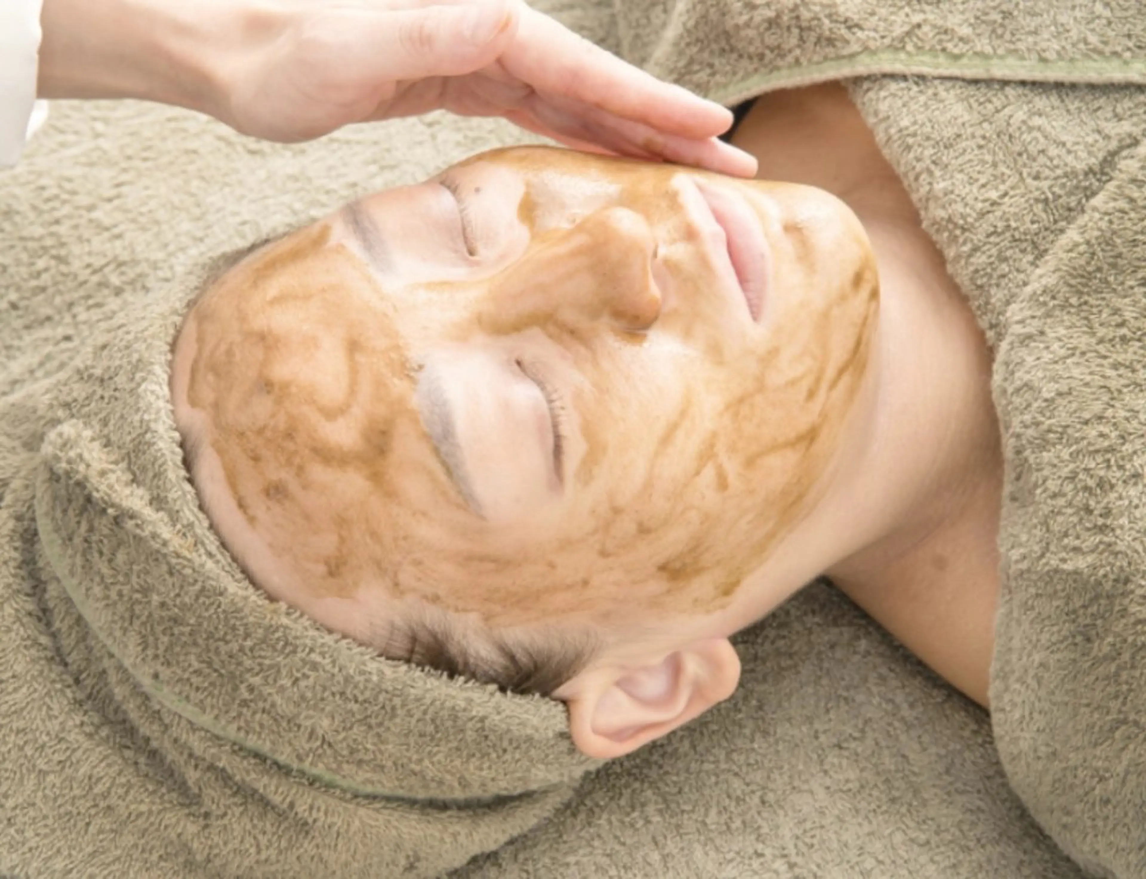 敏感肌ニキビケアに！ハーブピーリングの写真