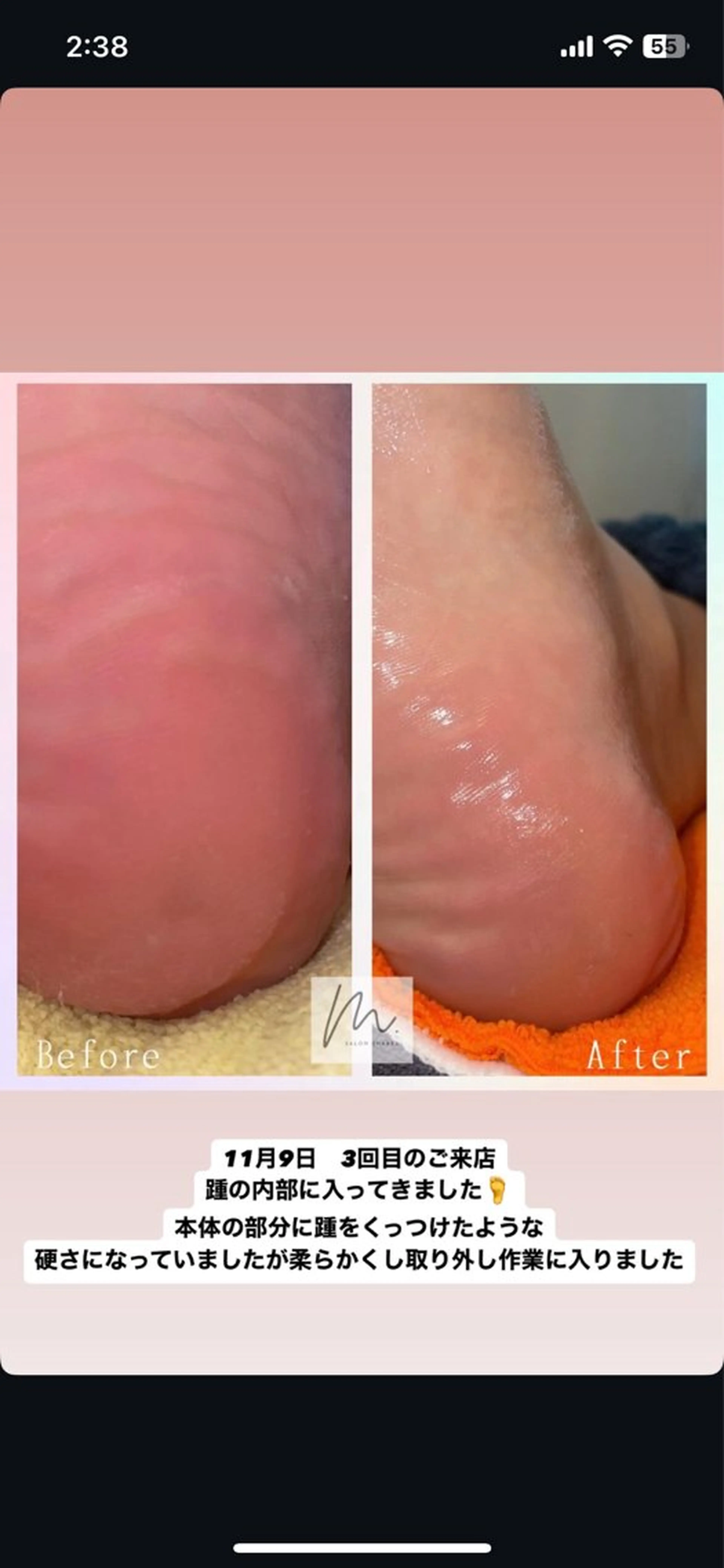 エステ リラク SHARES MADOKAのエステ・リラクイメージ