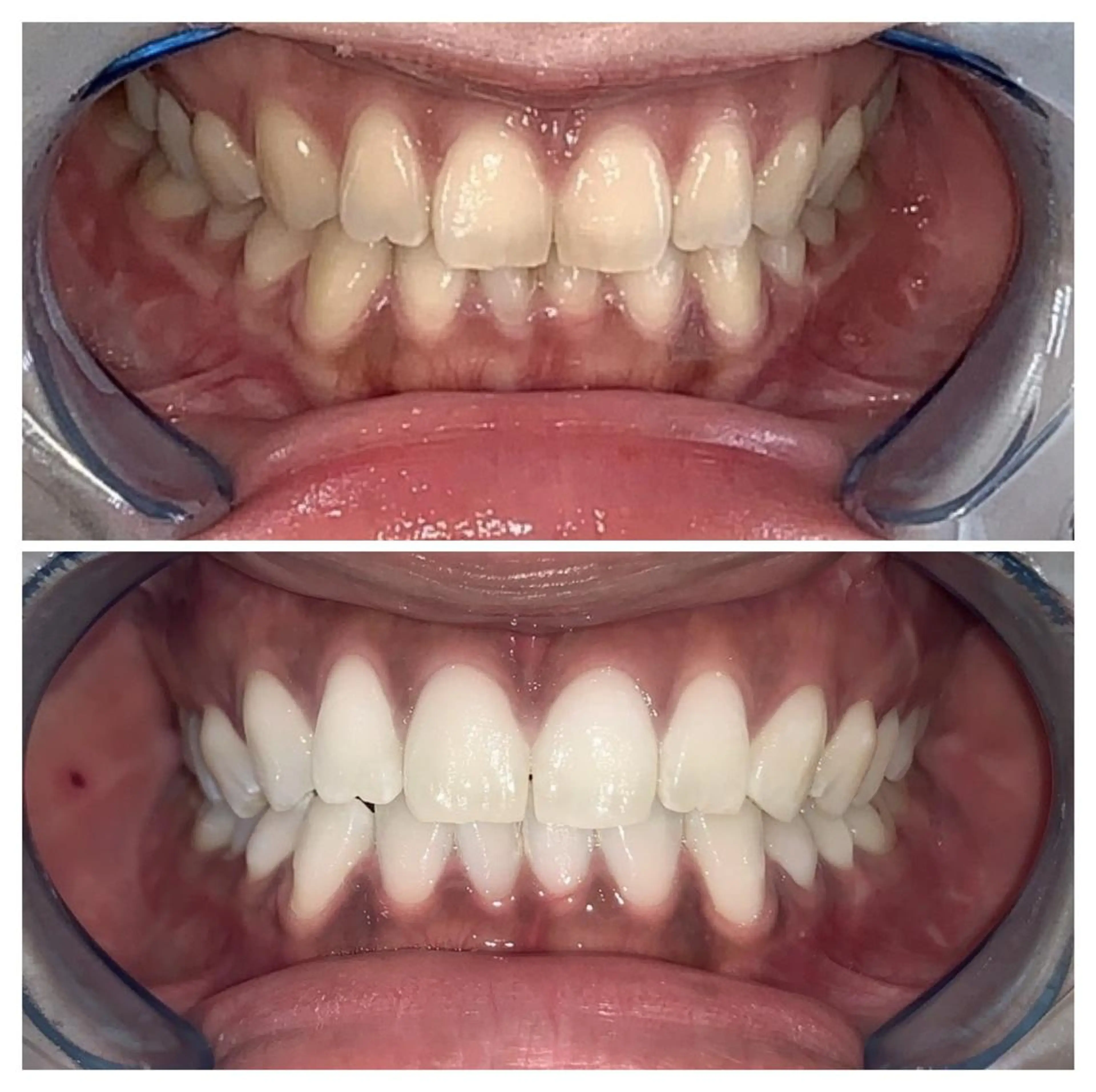 ヘアアレンジ ネイル マツエク・マツパ メンズ カラー パーマ アイブロウ キッズ ショート エステ リラク ライトビューティー 銀座店のエステ・リラクイメージ