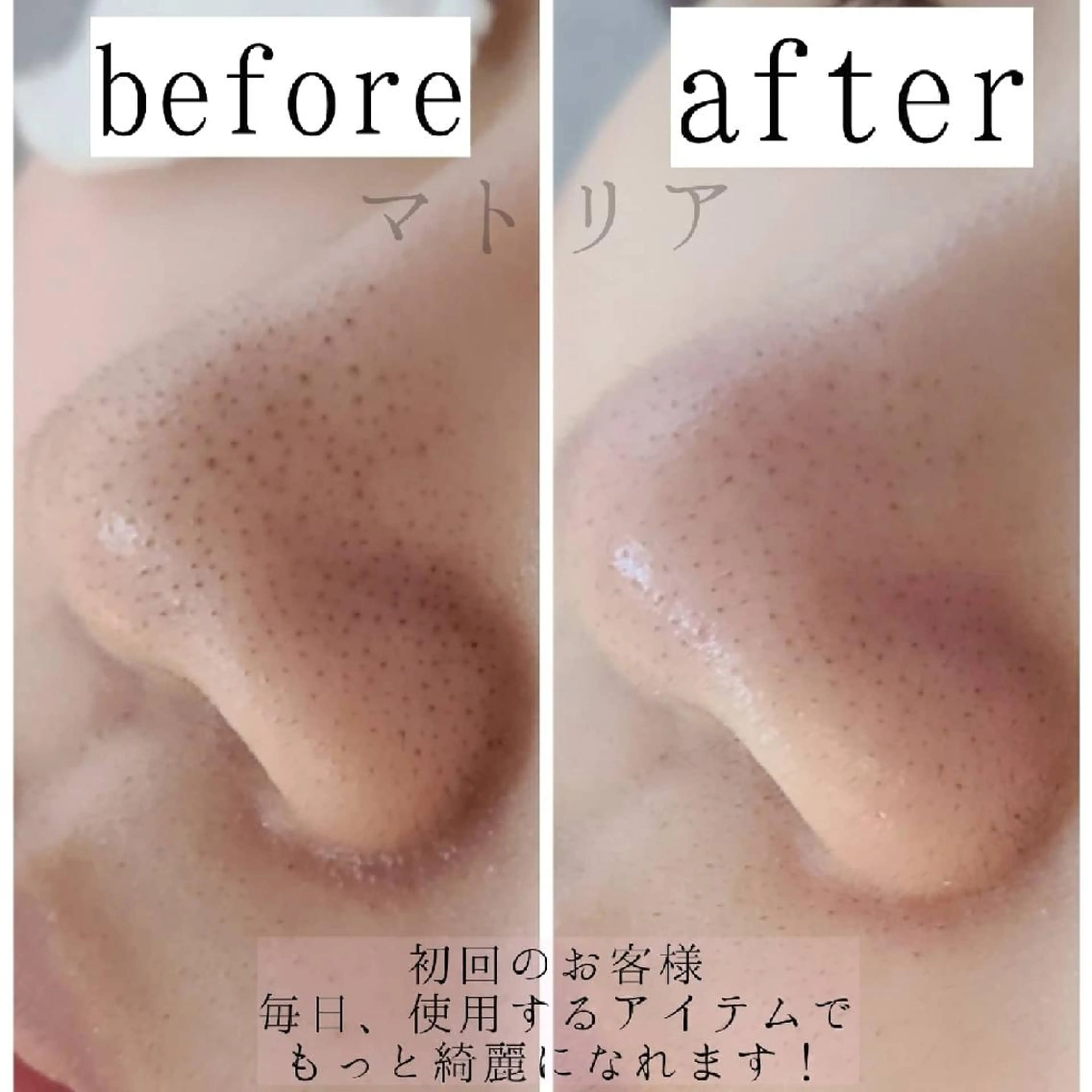 エステ 小顔と美肌 まごころエステMatoria所属・小顔 美肌専門 Matoriaのエステ・リラクイメージ