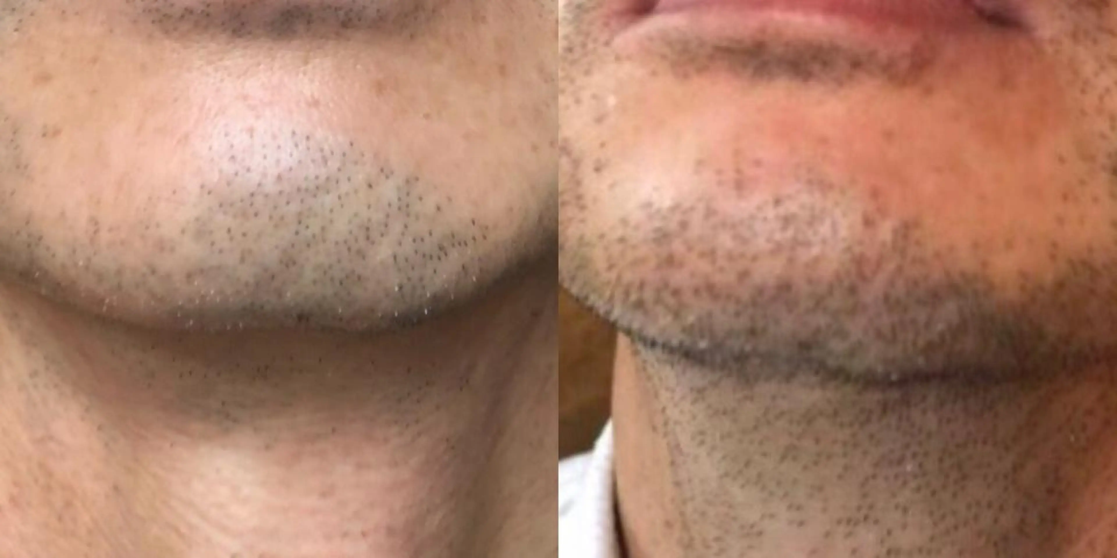 メンズ 井上 みあのエステ・リラクイメージ