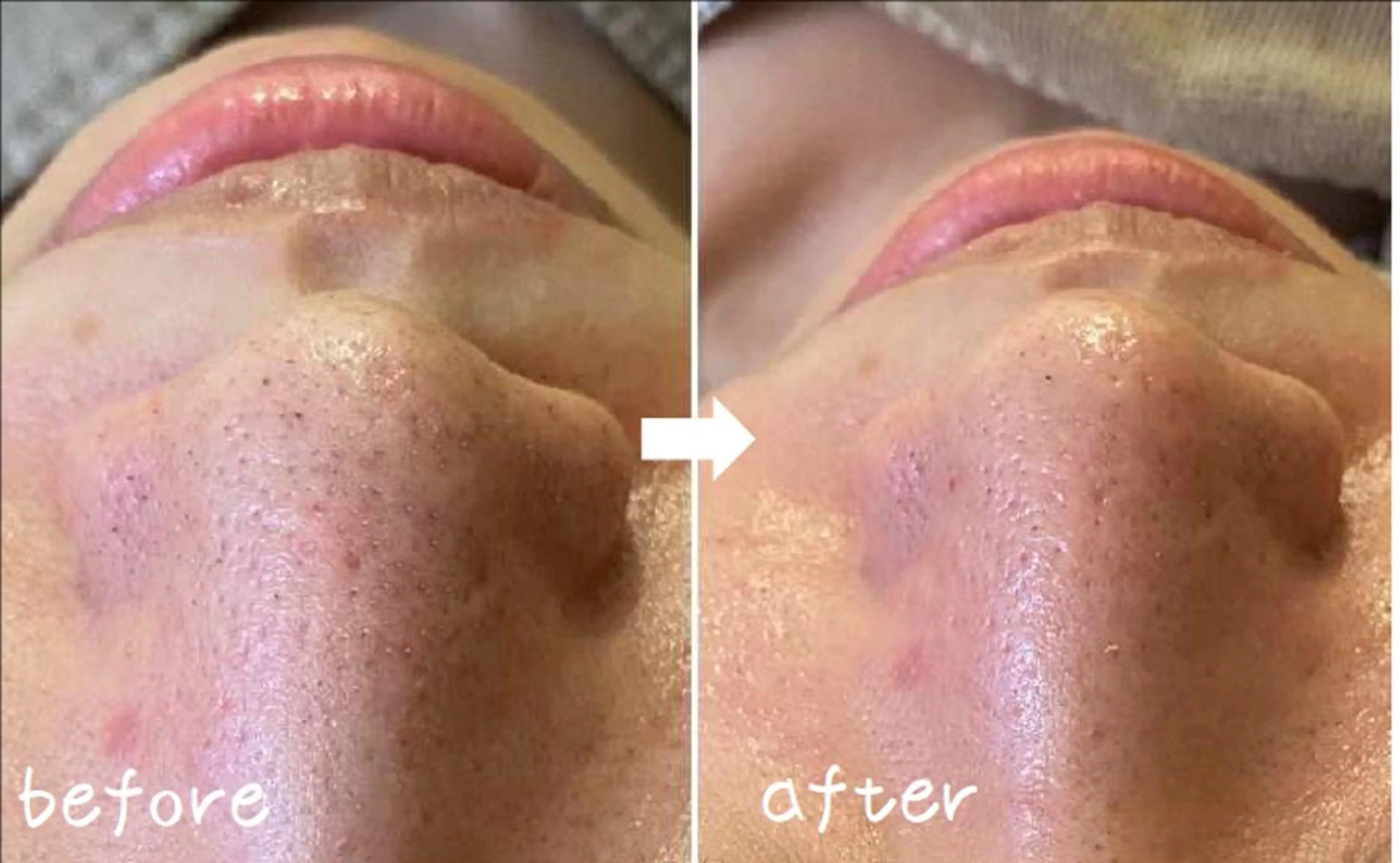 エステ 美肌専門サロン かれんのエステ・リラクイメージ