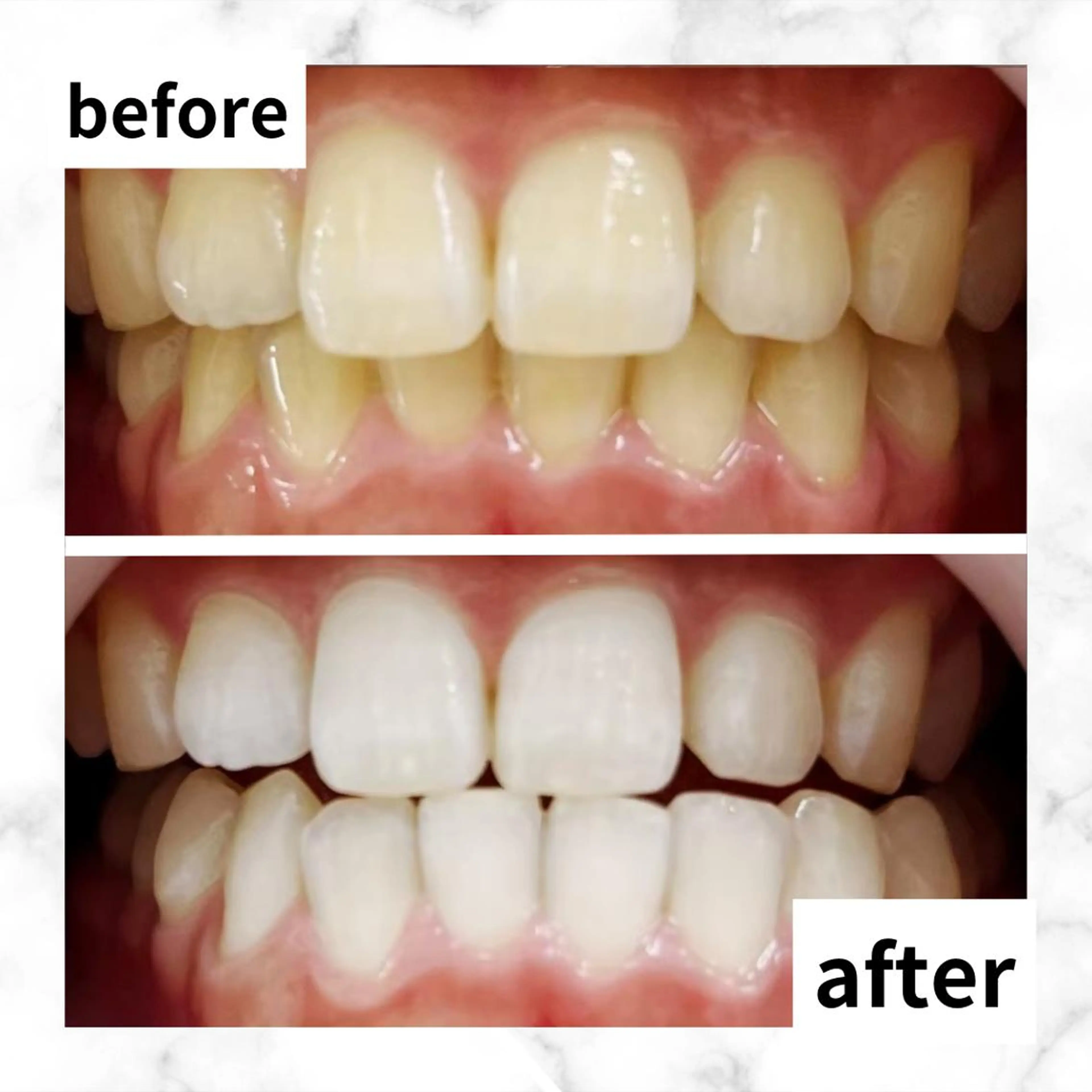 LBSホワイトニング 🌐渋谷店 河内のエステ・リラクイメージ