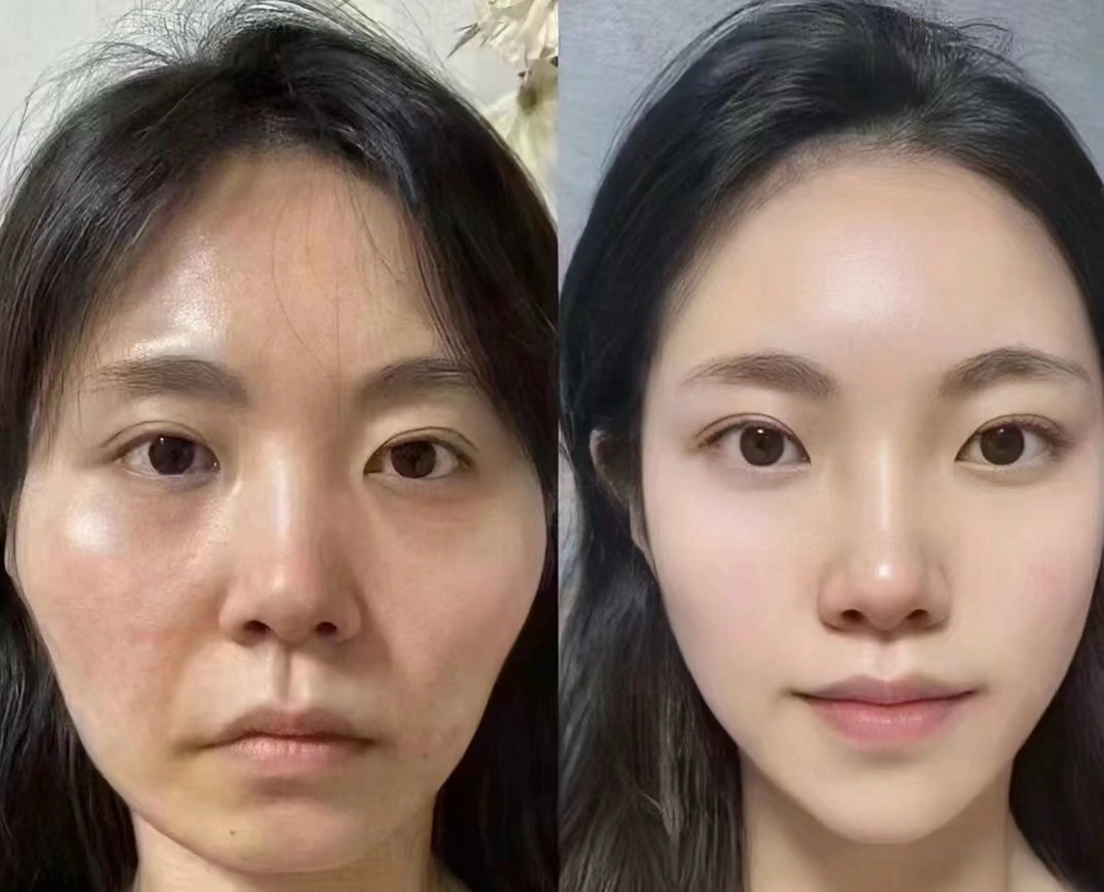 ネイル エステ リラク 愛維美水光美肌専門店所属・愛維美水光美肌専門店 メンズレディースokのエステ・リラクイメージ