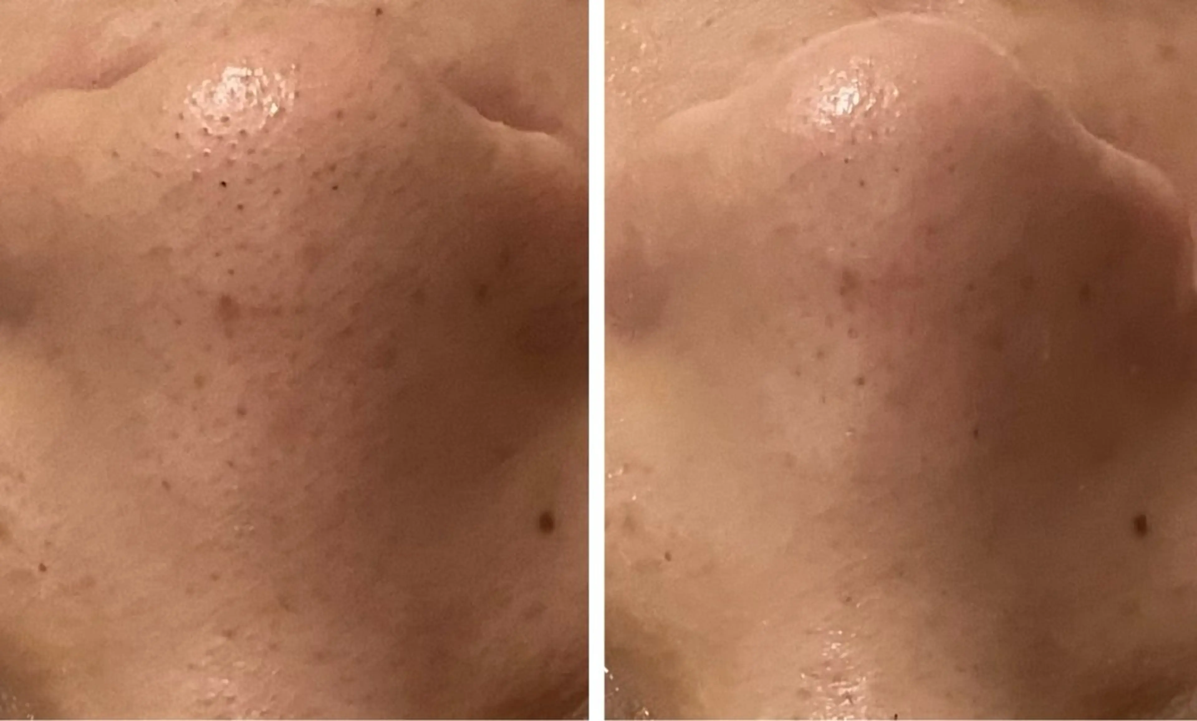 よもぎ蒸し30分+小顔フェイシャルケア+毛穴洗浄付🫧60分の写真