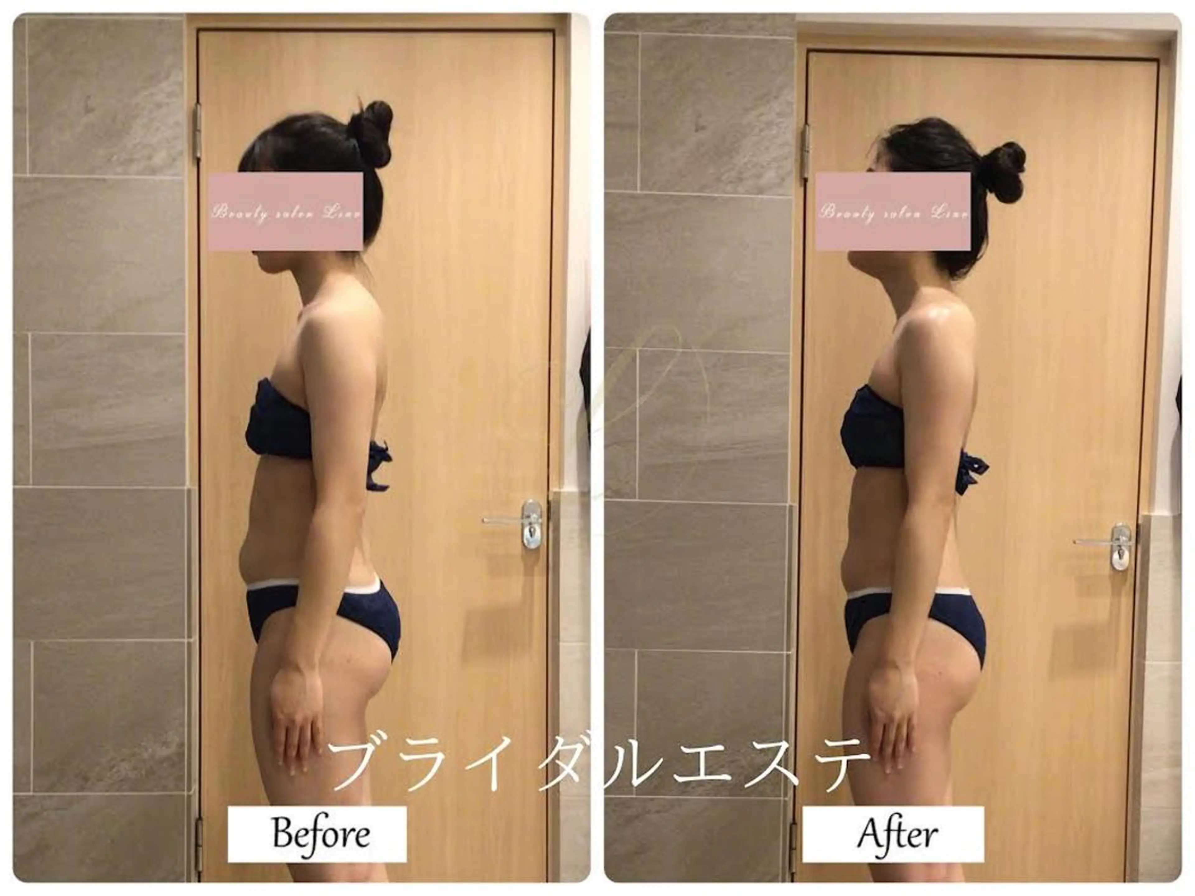 エステ リラク ブライダルサロン ｜Lino【堀江】のエステ・リラクイメージ