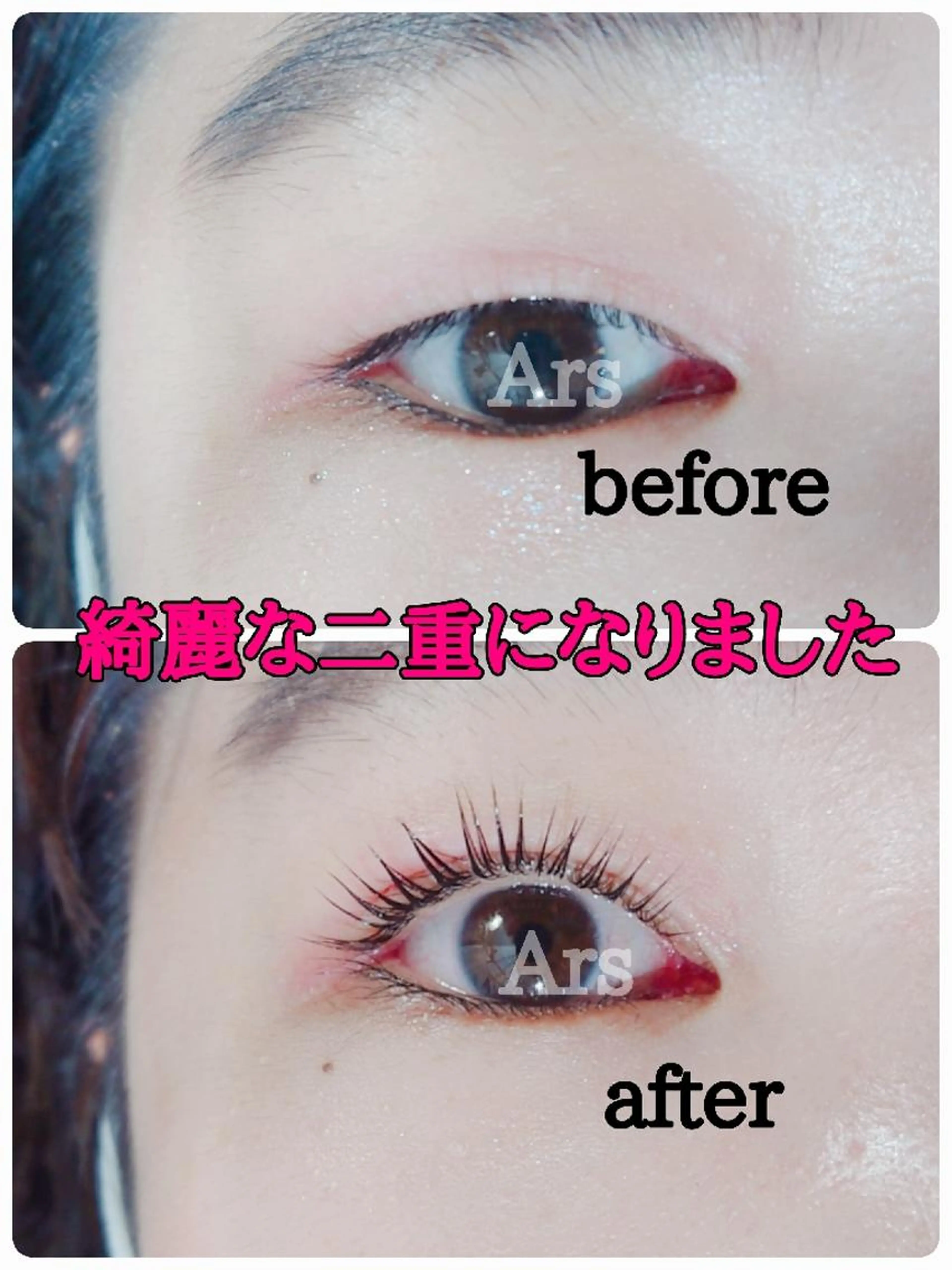 マツエクオフ🌼アイシャンプー付き🌼 アイリッドアップパーマ+マツエクオフ🌼濃厚トリートメント付🌼練習モニター募集の写真