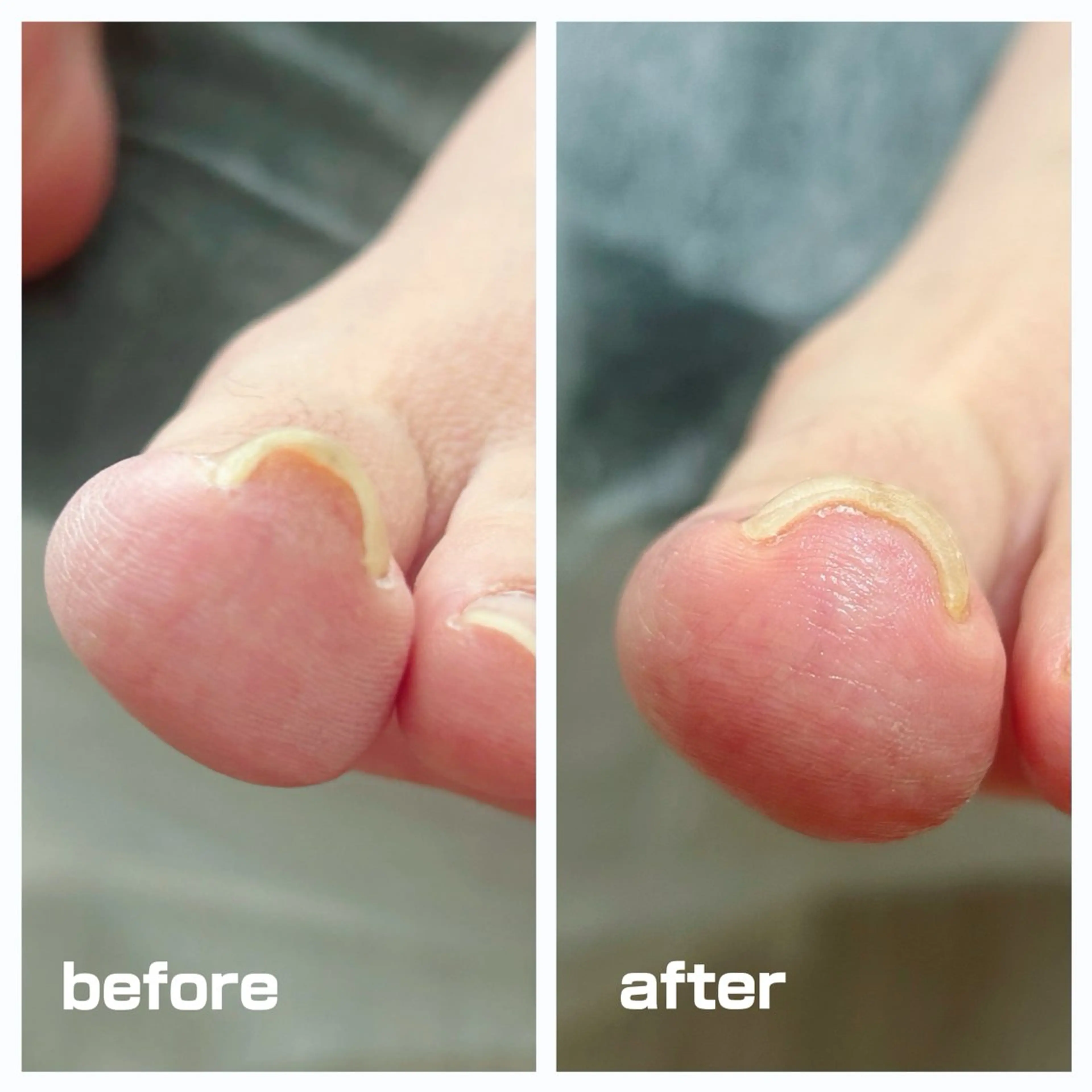 その他 フットケアサロン Kotoriのその他イメージ