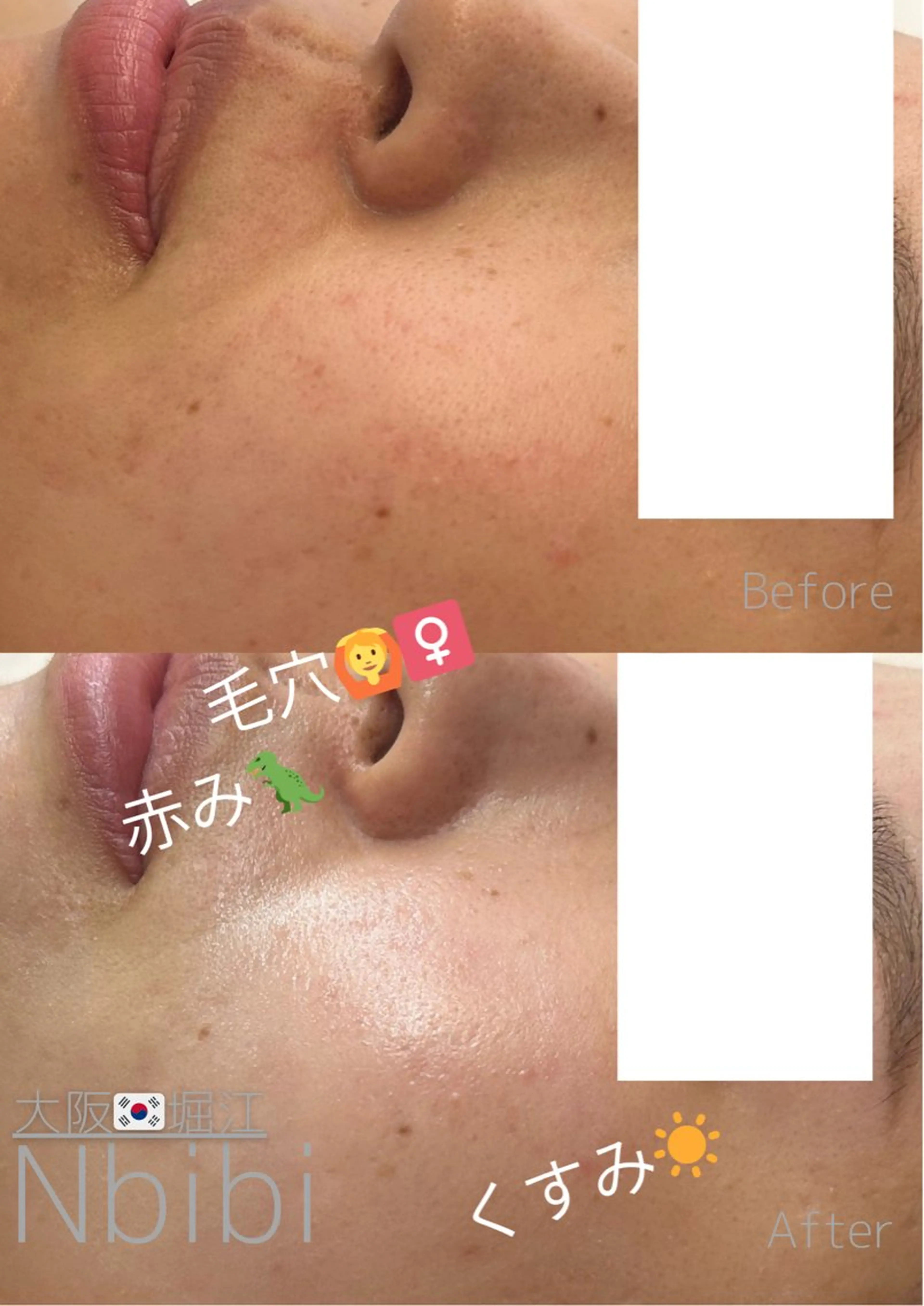 エステ 韓国🇰🇷価格 サロン_Nbibiの眉毛・アイブロウイメージ