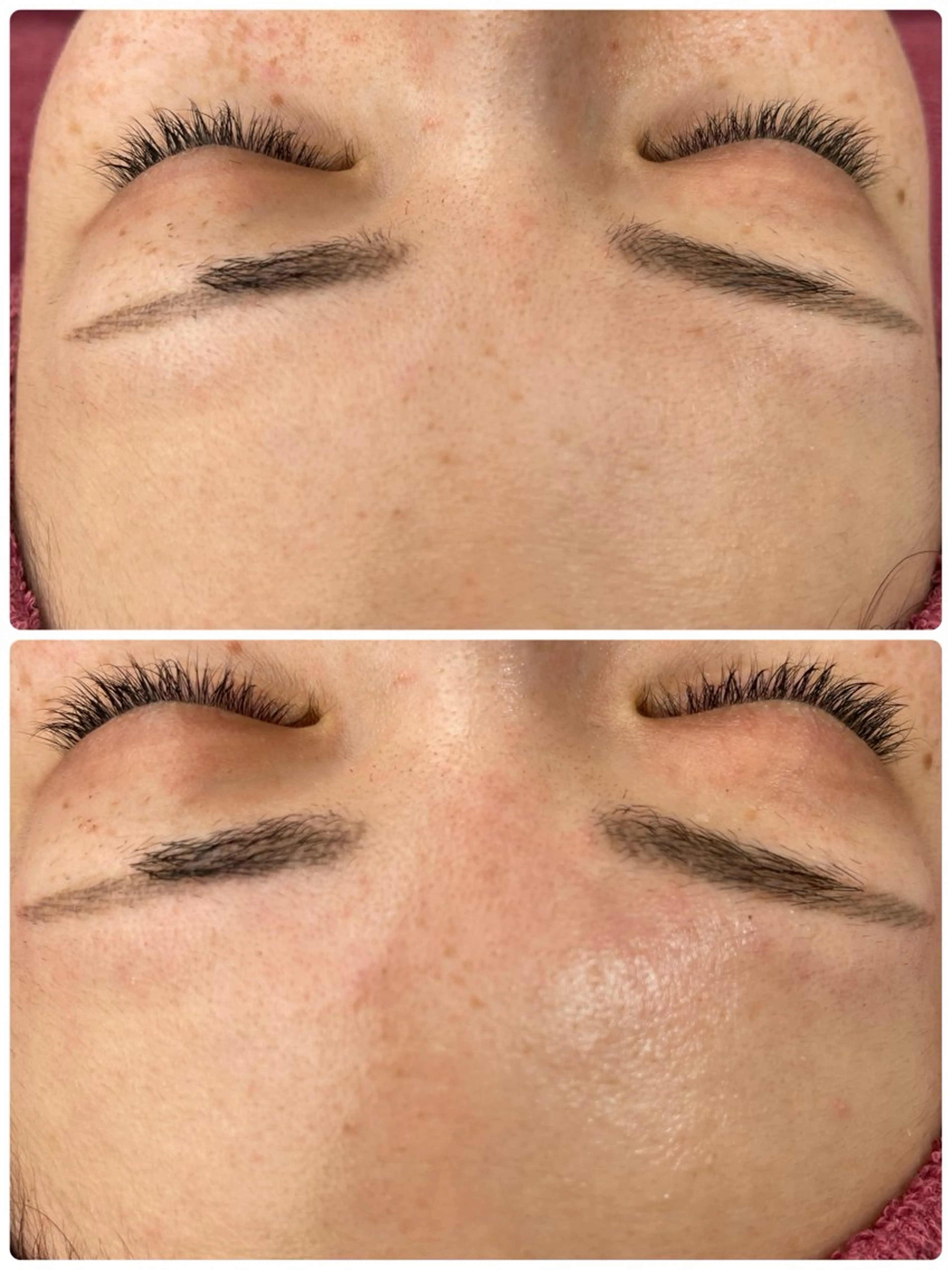 エステ REVI取扱・肌悩み 毛穴Chalonのエステ・リラクイメージ