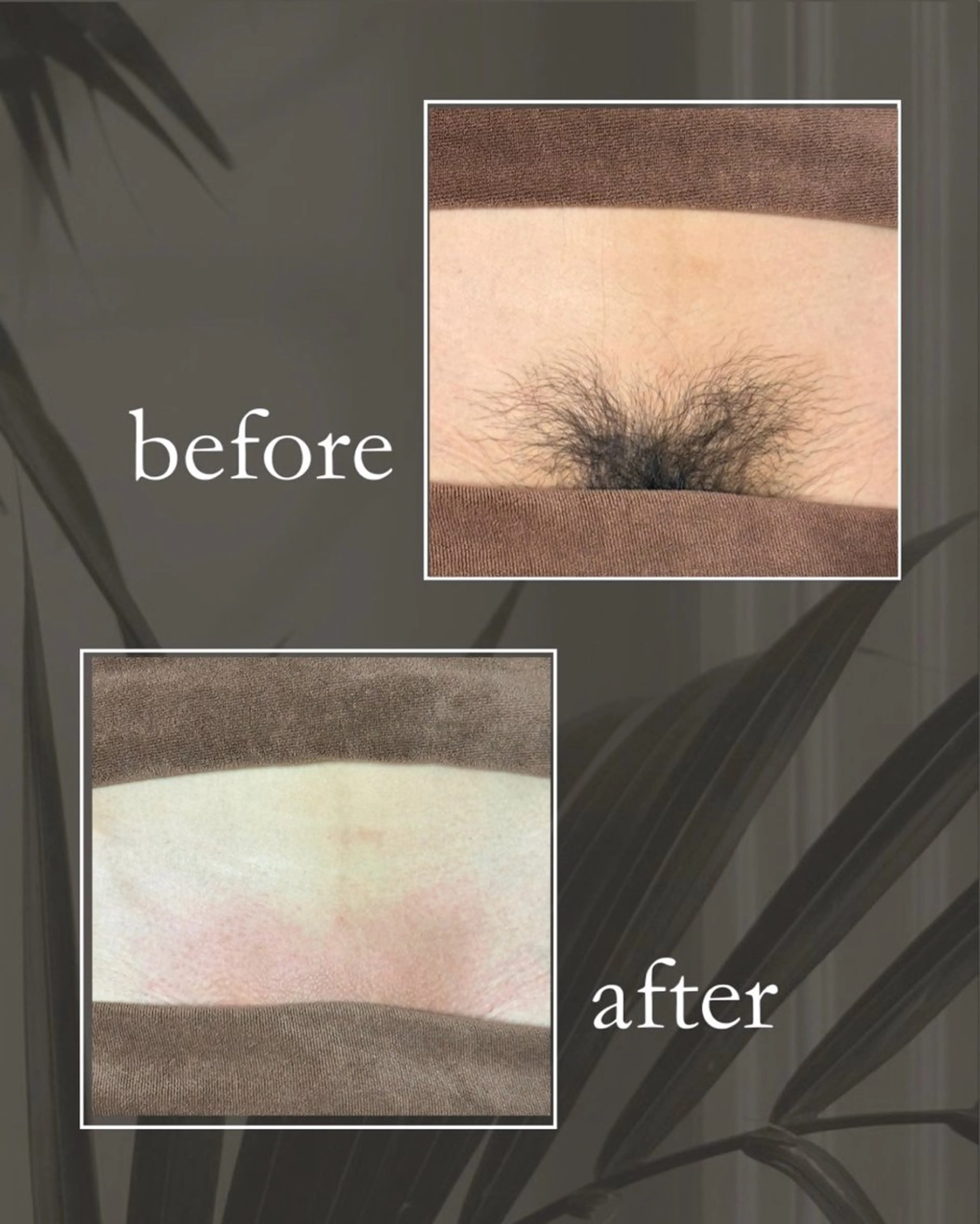 脱毛 砂原 慧子のエステ・リラクイメージ