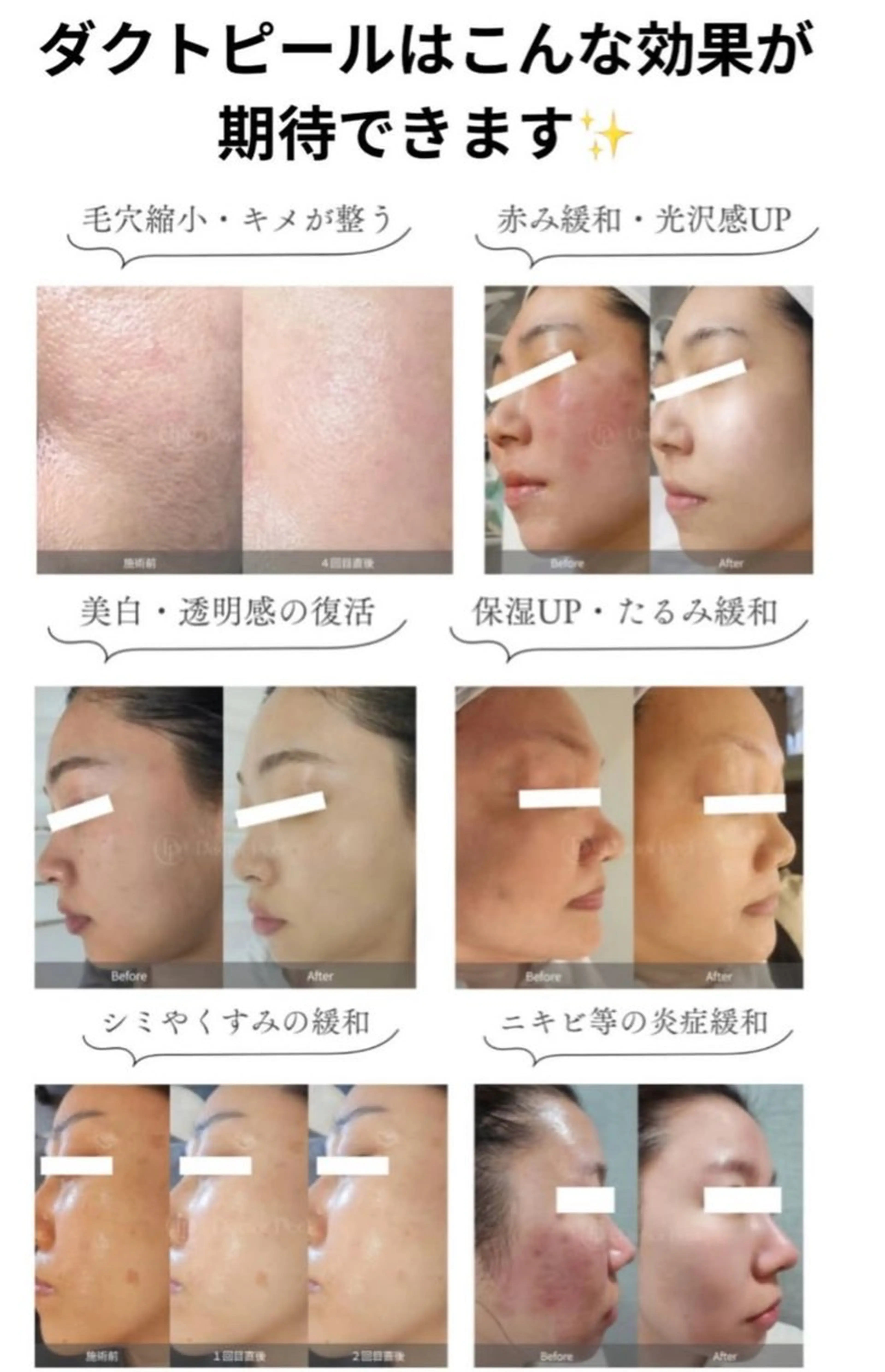 その他 トータルボディケア chouchouのエステ・リラクイメージ