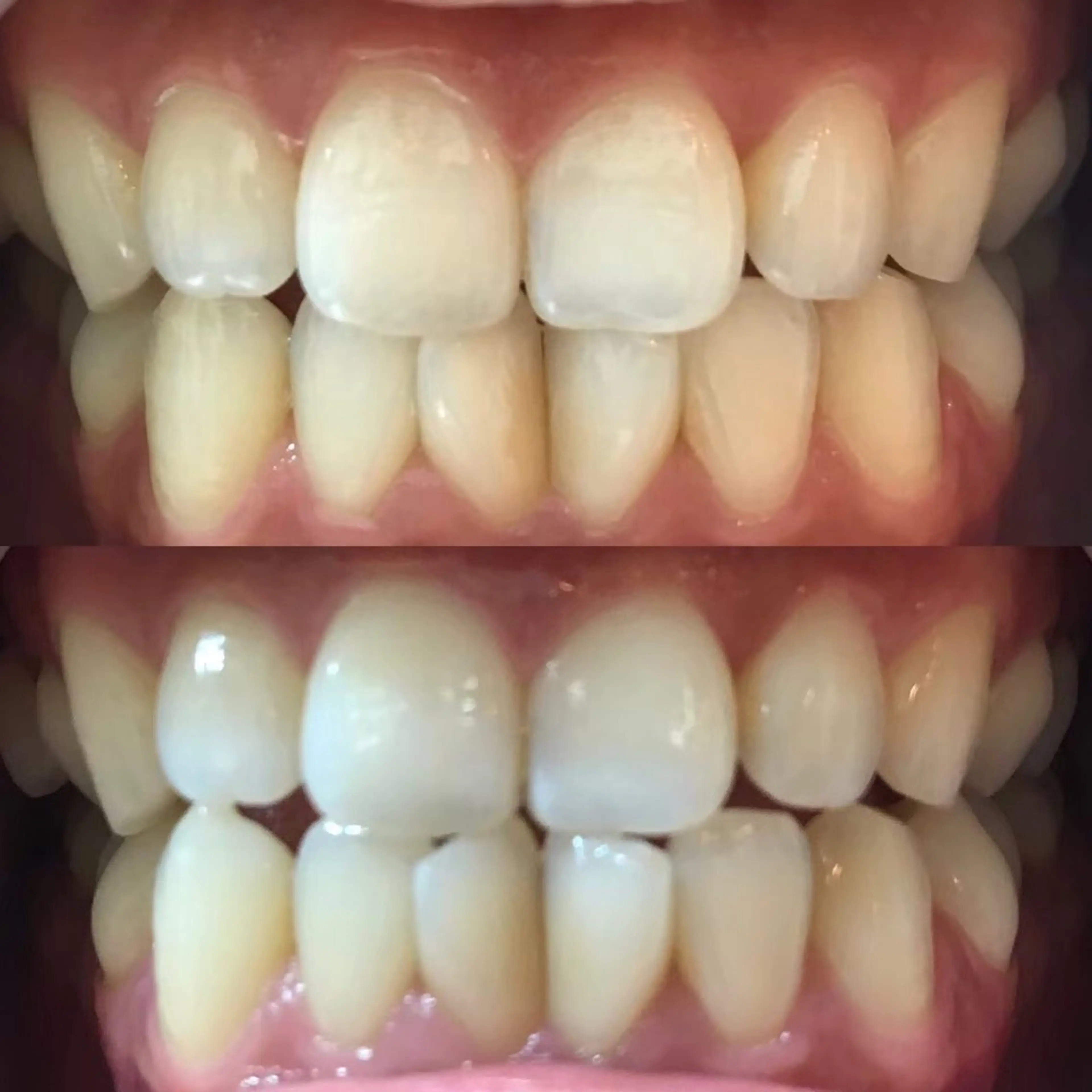 エステ リラク LBSホワイトニング 🌐 上野店公式のエステ・リラクイメージ