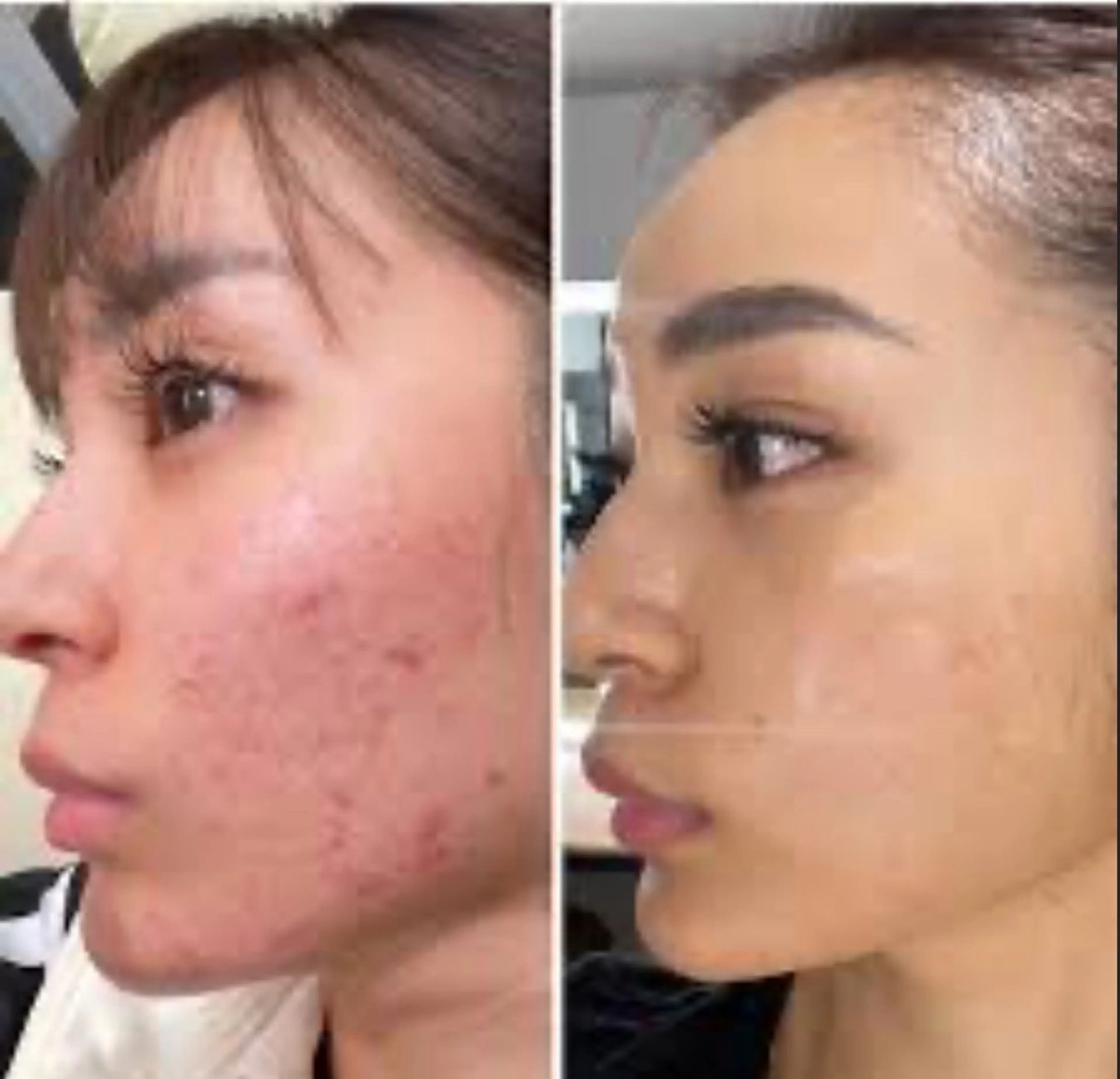 エステサロン ルーサ所属・和賀 ひろこのエステ・リラクイメージ