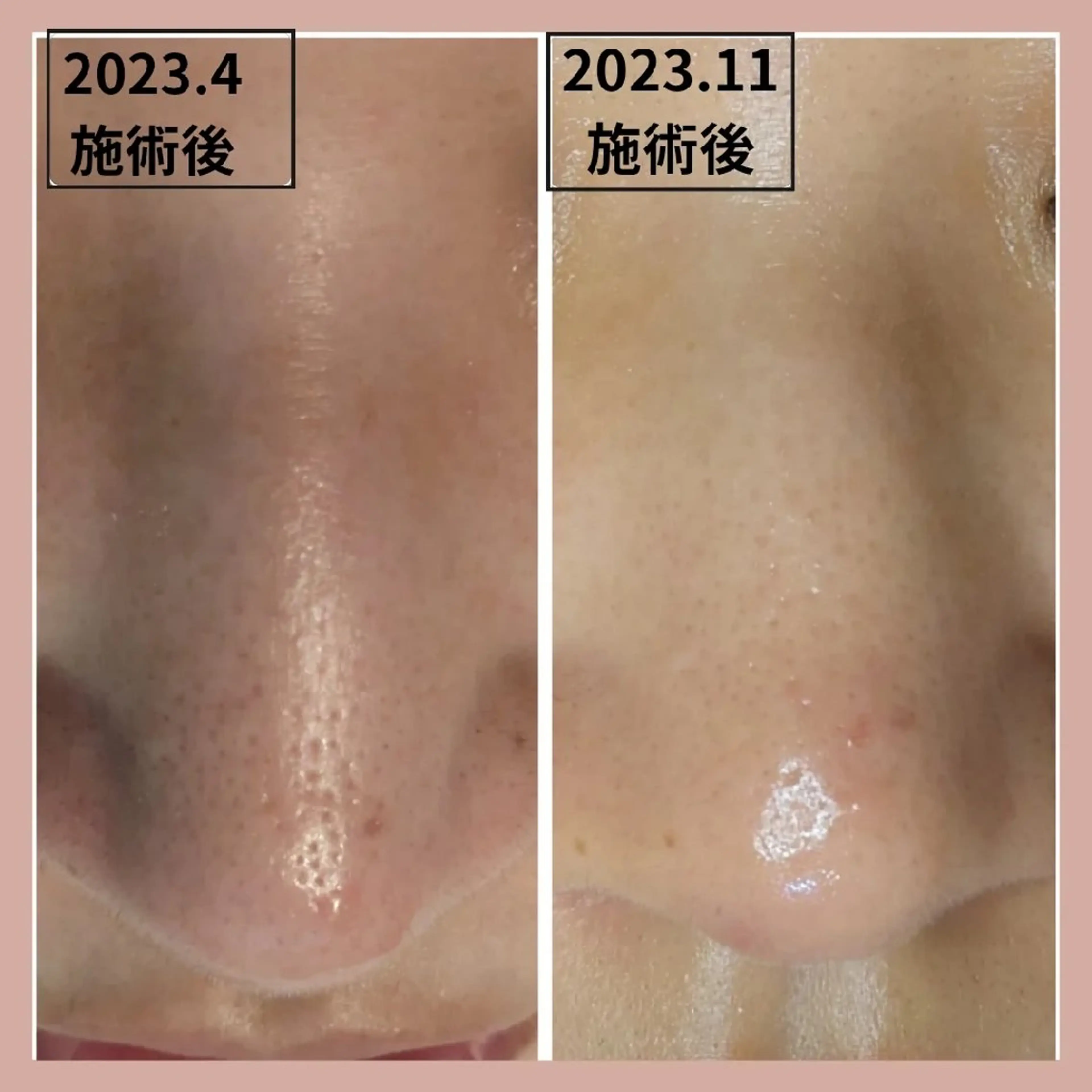 フェイシャル/毛穴 /シミ/たるみ東灘区のエステ・リラクイメージ