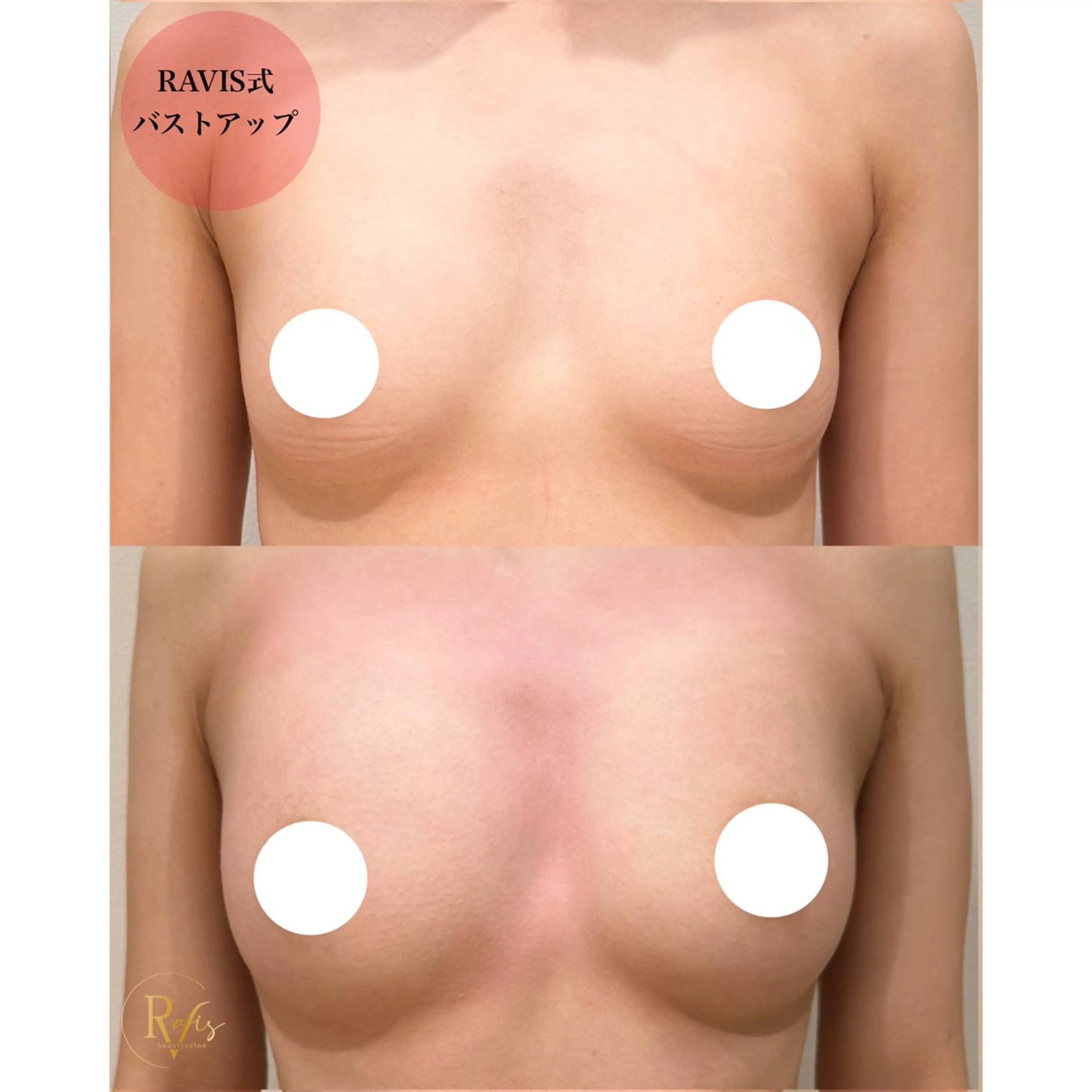 エステ 東大阪/韓国肌管理/ 痩身バスト専門店のエステ・リラクイメージ