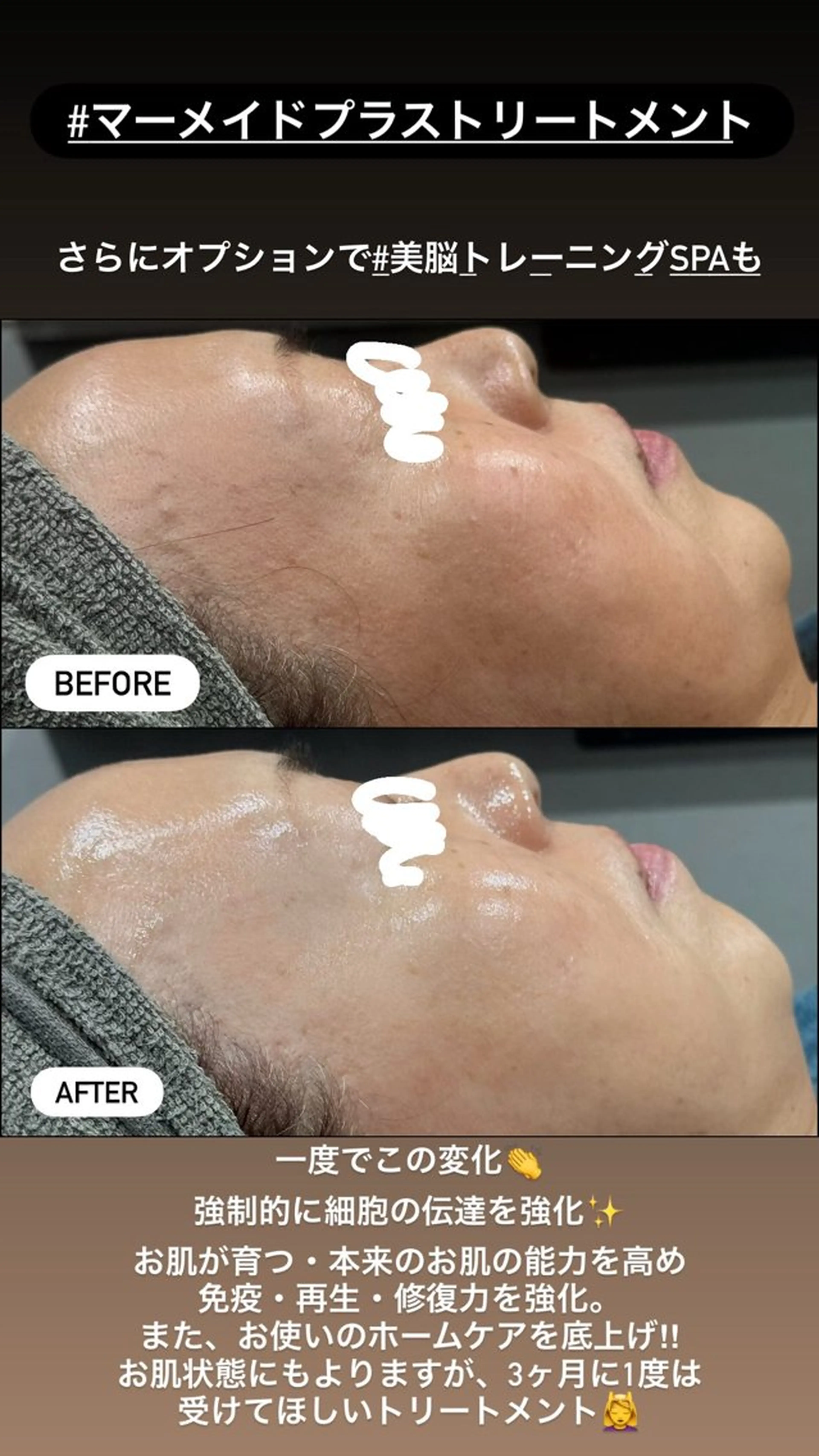 エステ LiZA エステティックサロンのエステ・リラクイメージ