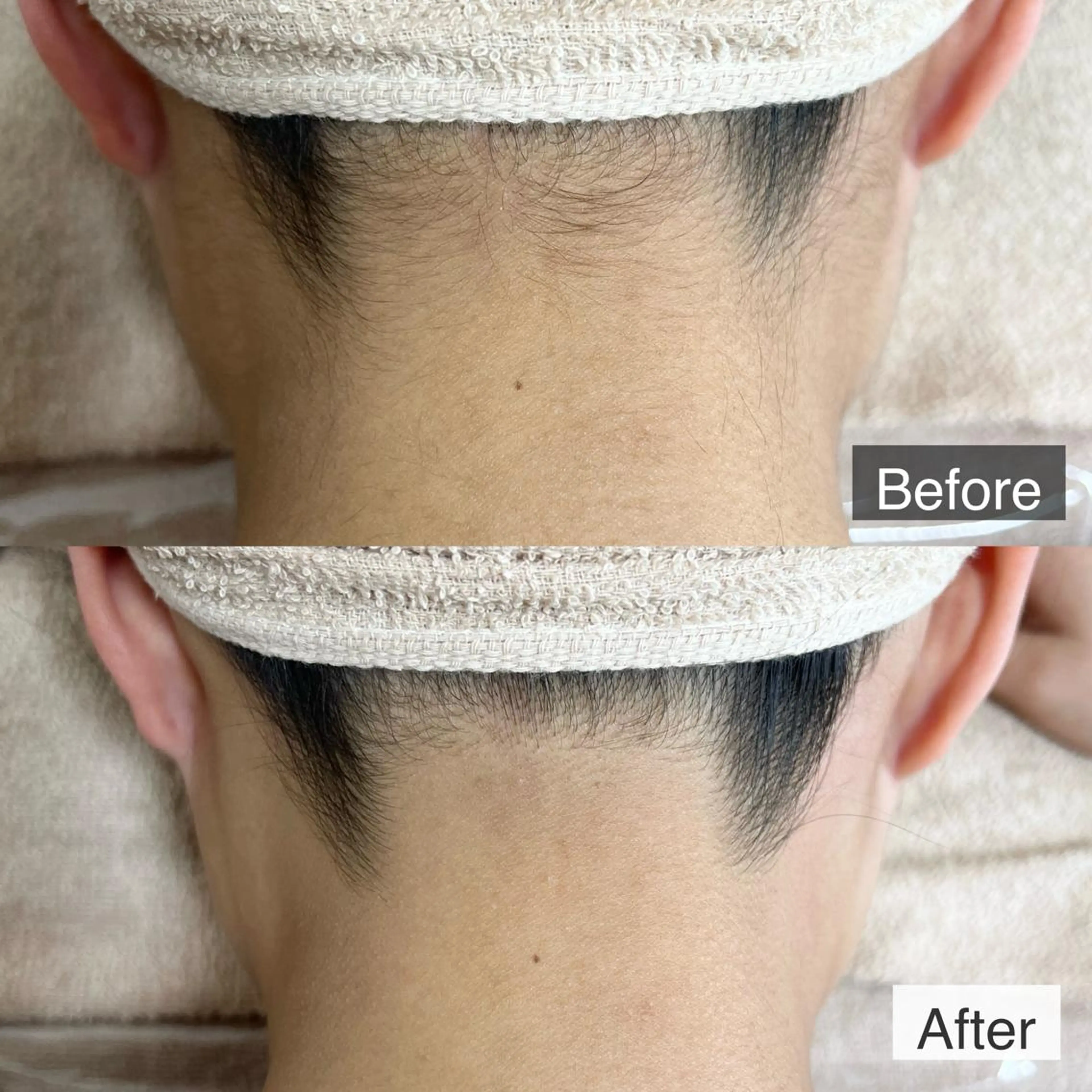 脱毛 脱毛専門サロン BELFINE恵比寿のエステ・リラクイメージ