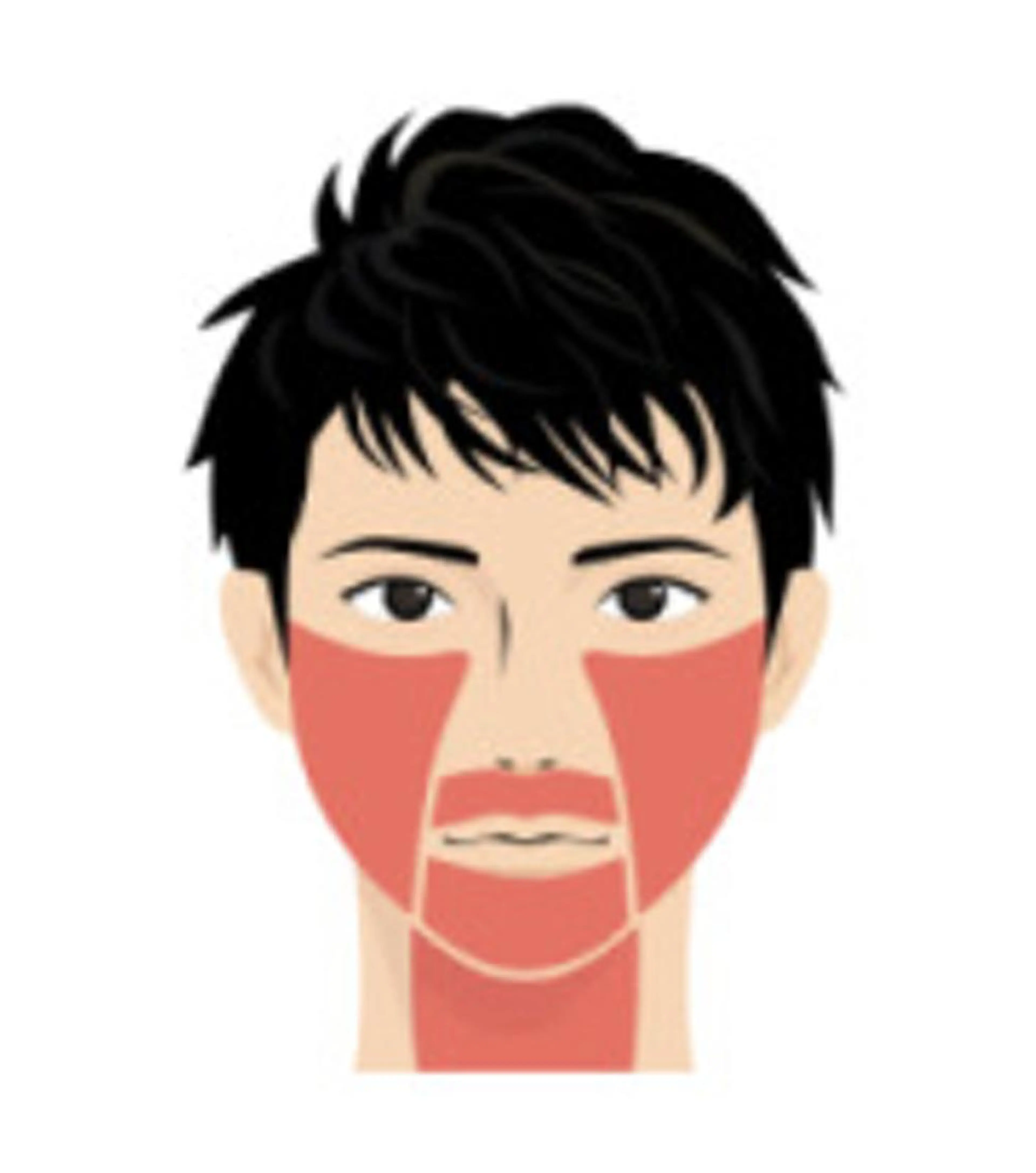 【脱毛期間限定！】3回まで同価格♪メンズヒゲ脱毛 1回　※2回目以降はお尋ね下さいませ。の写真