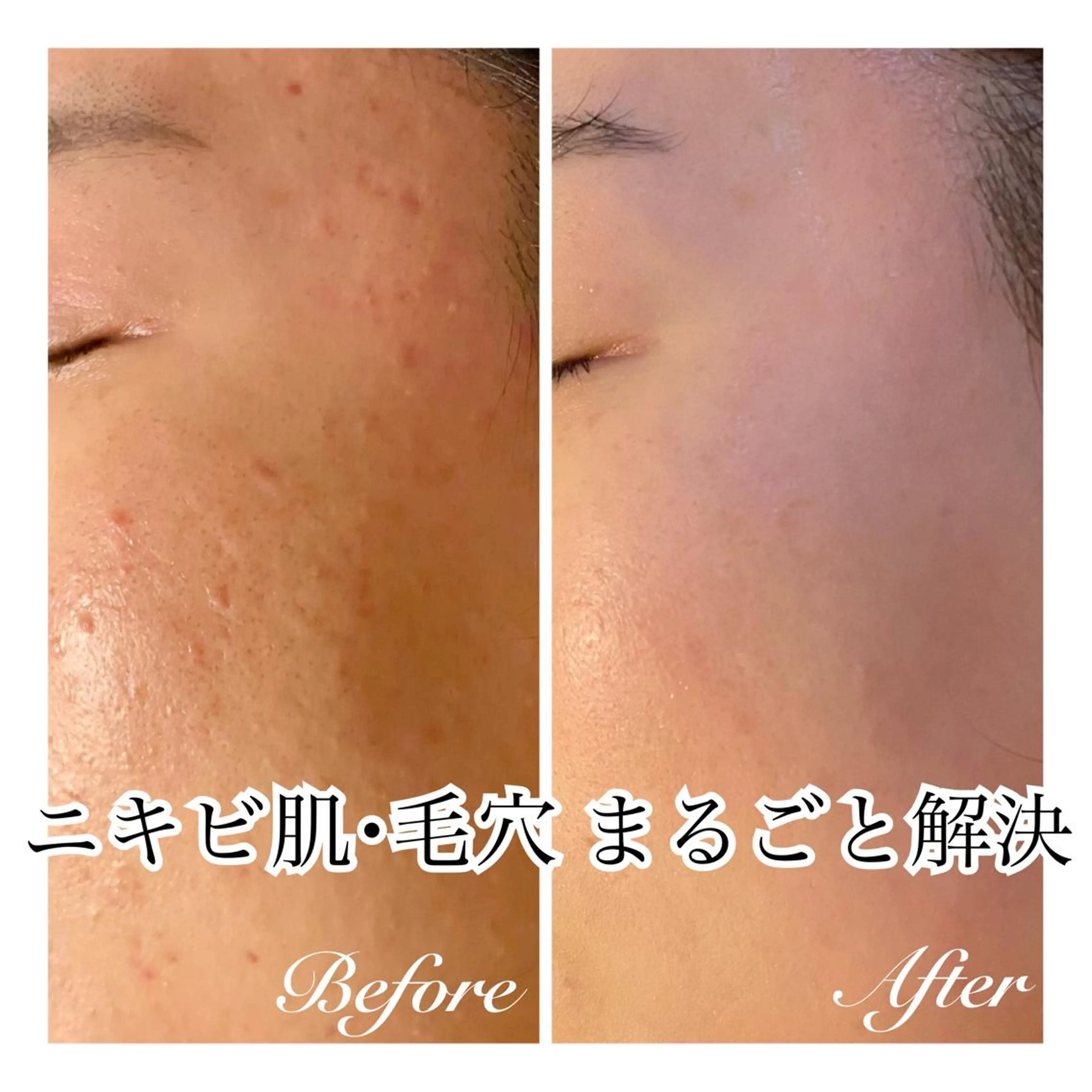 エステ リラク ダイエット・美肌ケア fleurのエステ・リラクイメージ