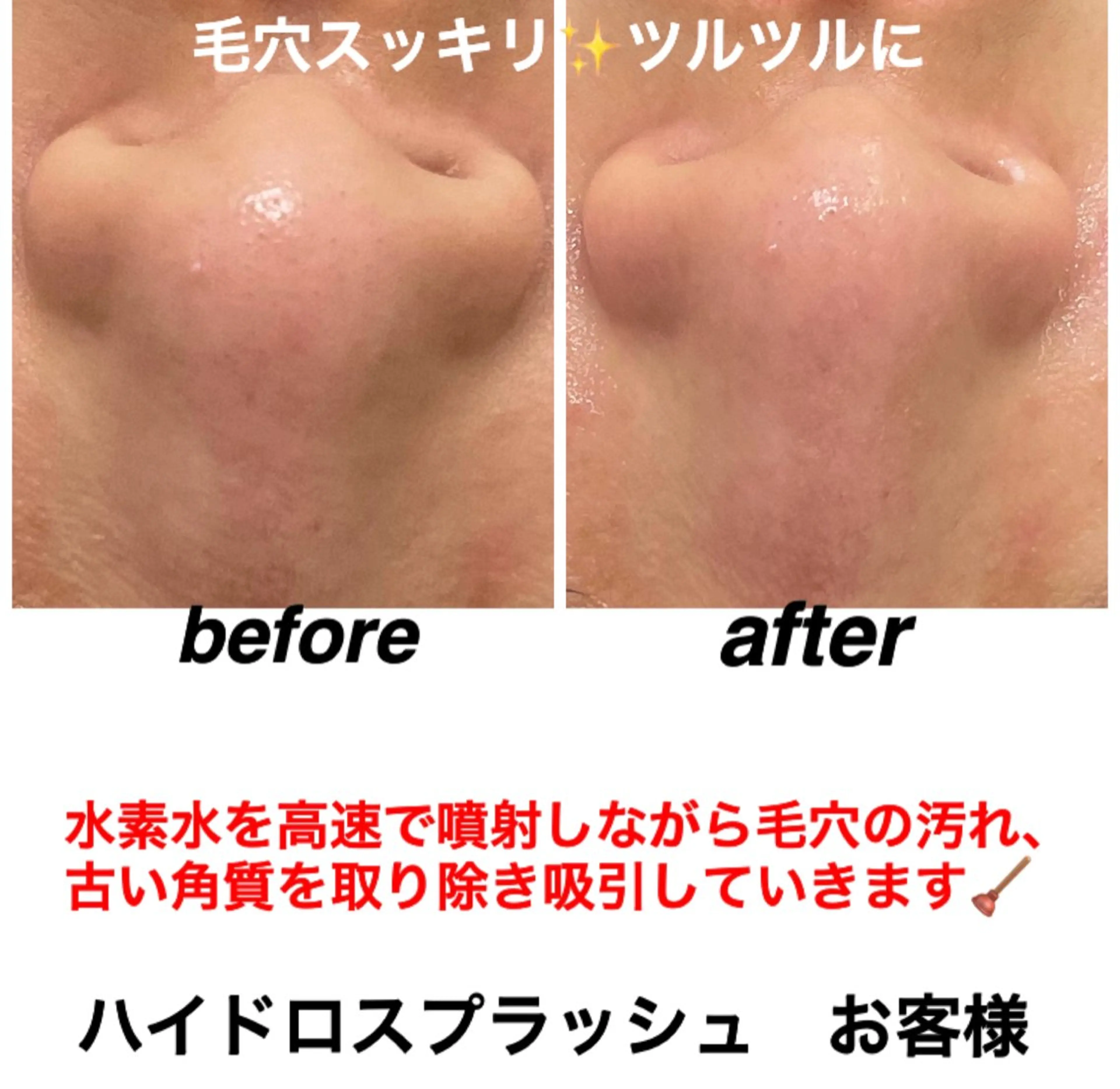 エステ リラク ネイル・エステサロン UILANIのネイルデザイン