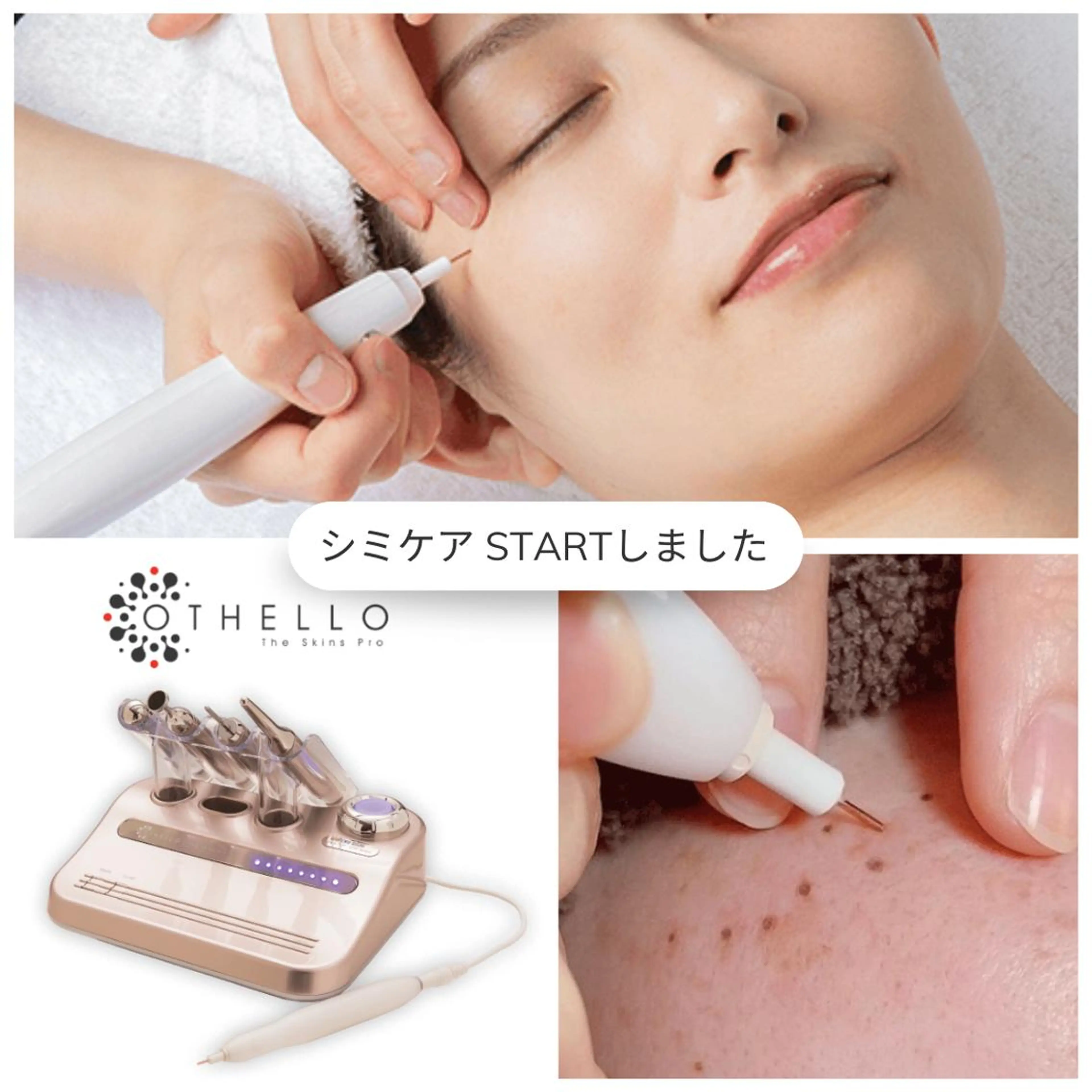 シミケアの写真