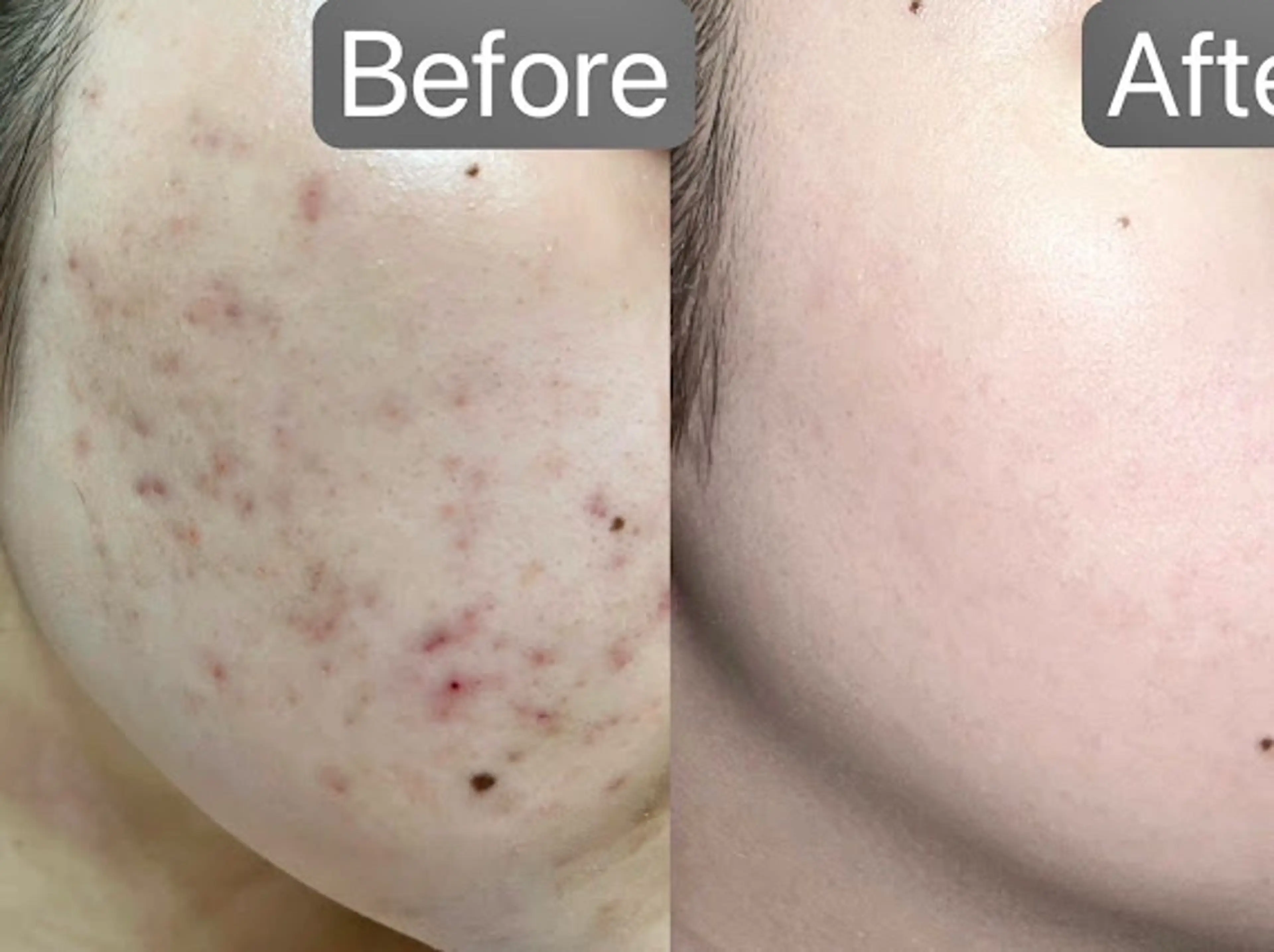 韓国肌管理Belle 桜木町のエステ・リラクイメージ