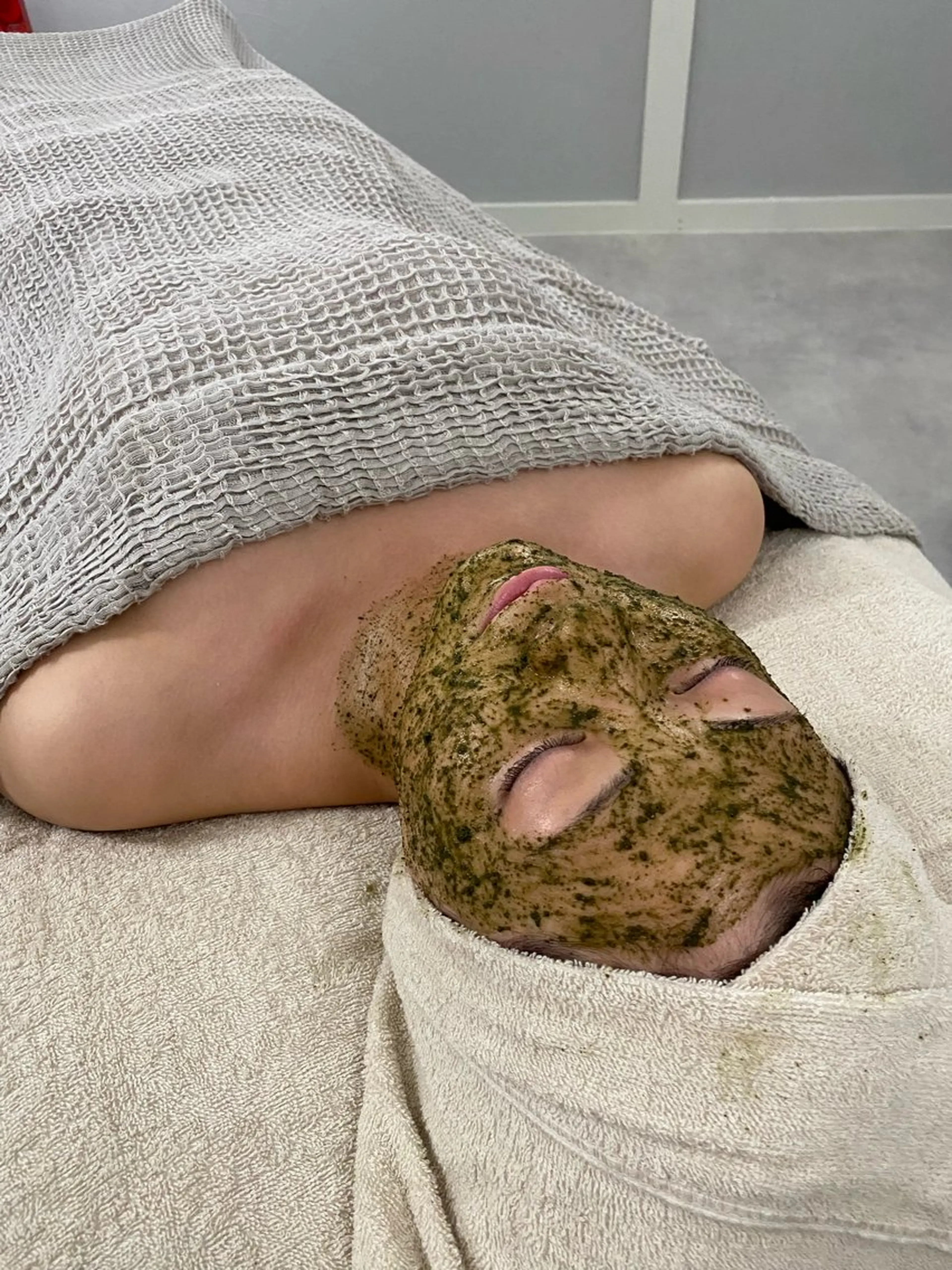 剥けない幹細胞ハーブピーリングの写真