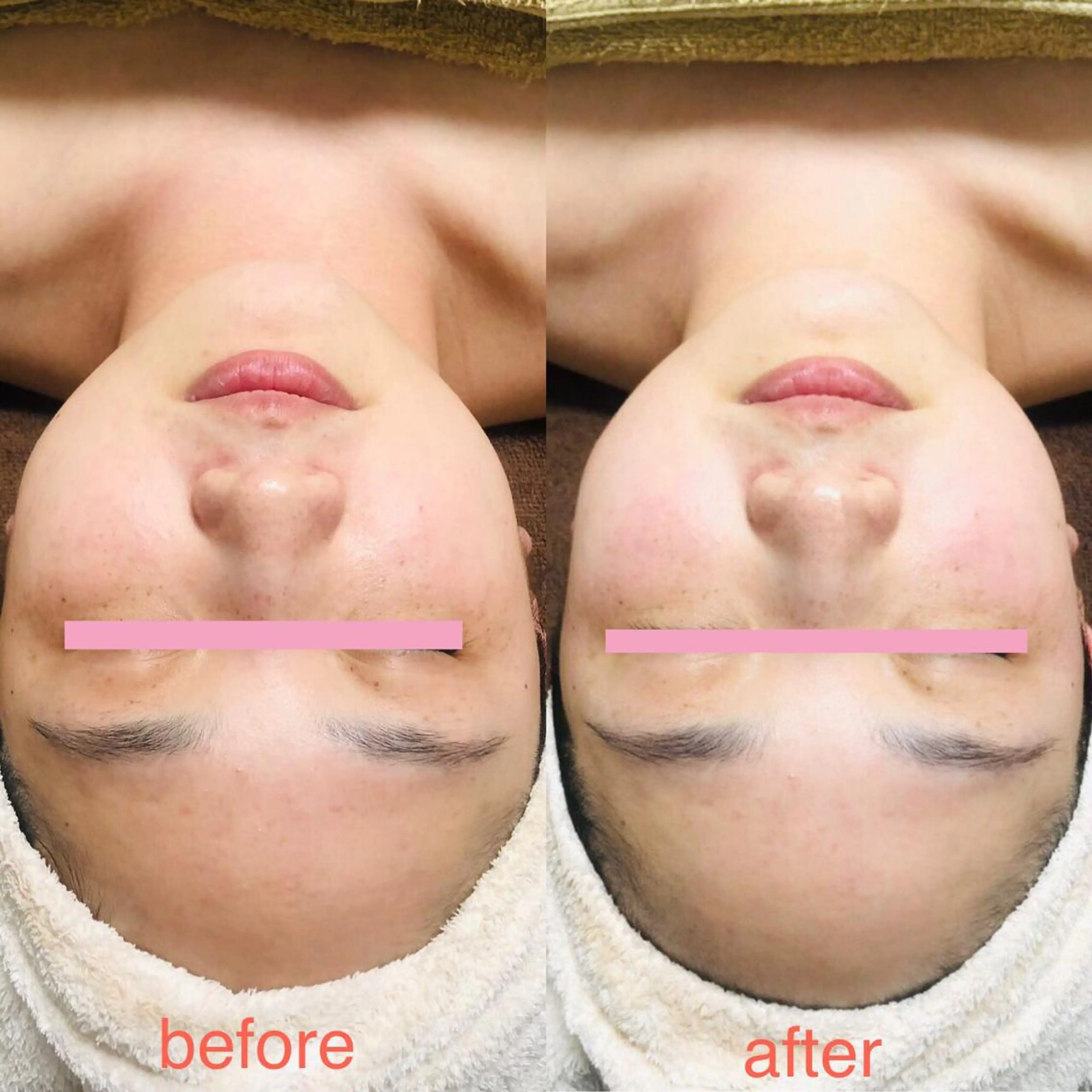 Lunon 【ルノン】のエステ・リラクイメージ