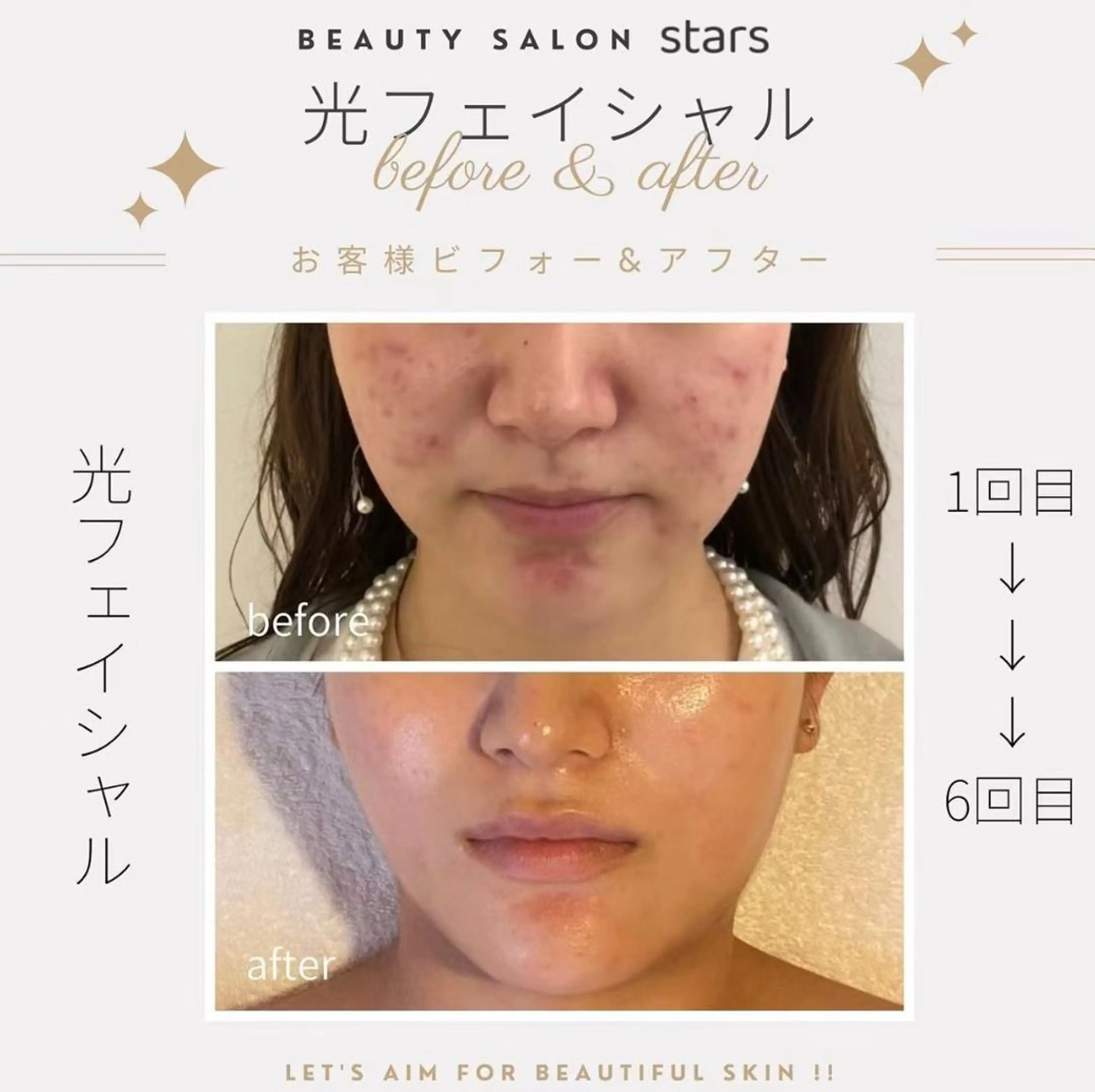 赤羽Stars beautyのエステ・リラクイメージ
