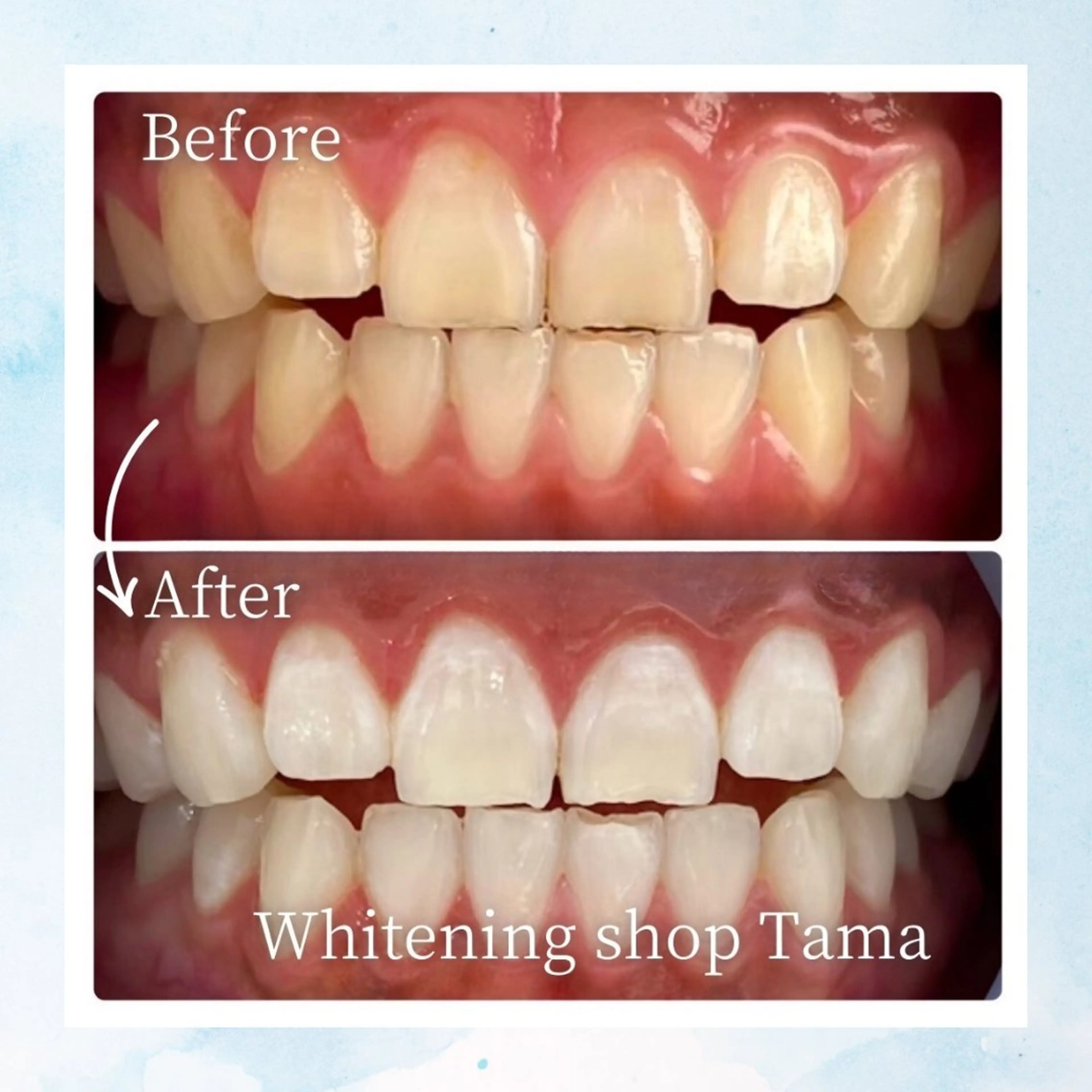 ホワイトニング ショップ多摩店のその他イメージ