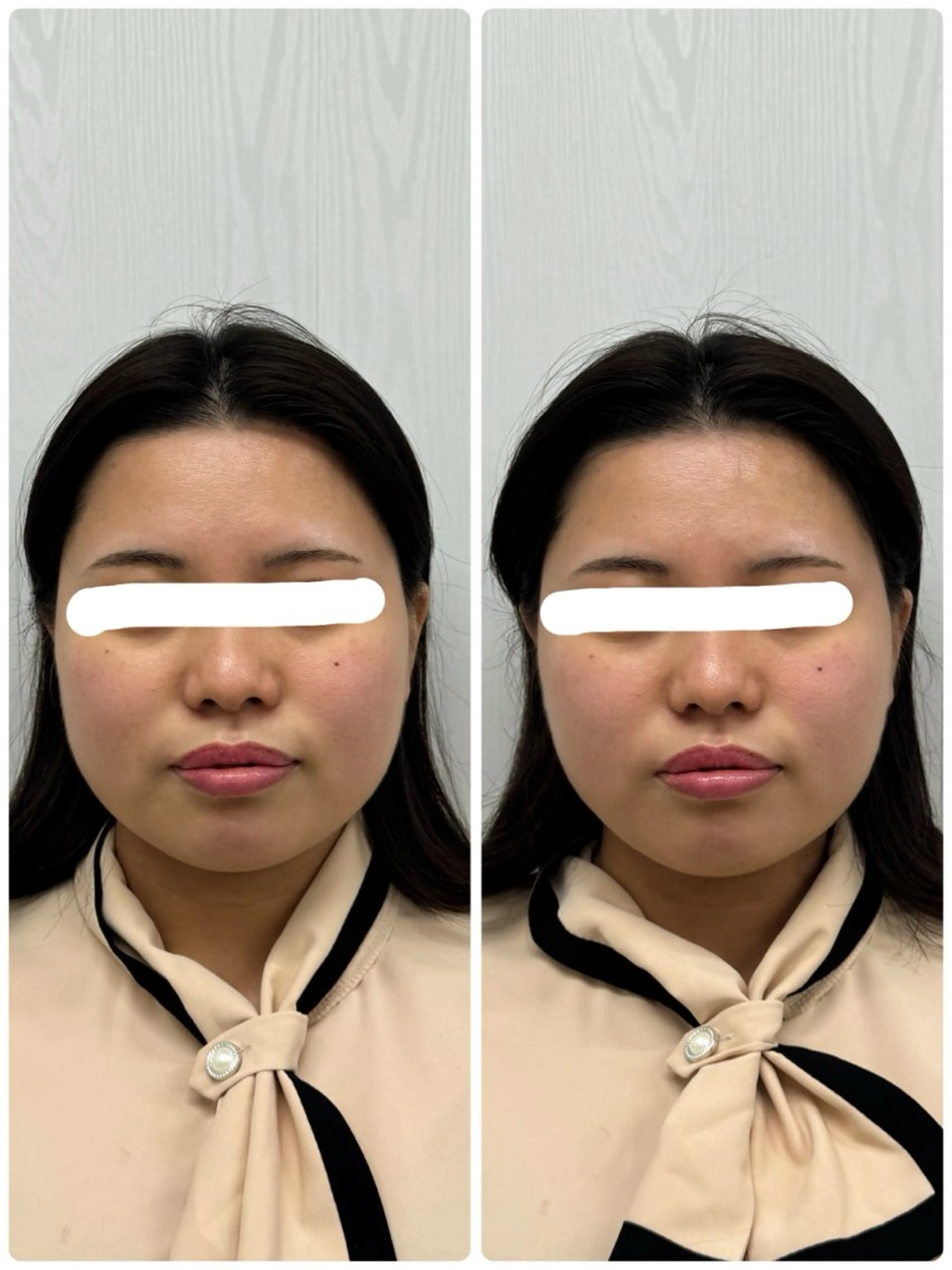 エステ リラク 美容鍼×小顔矯正 ×美容整体　浜川泰仁のエステ・リラクイメージ