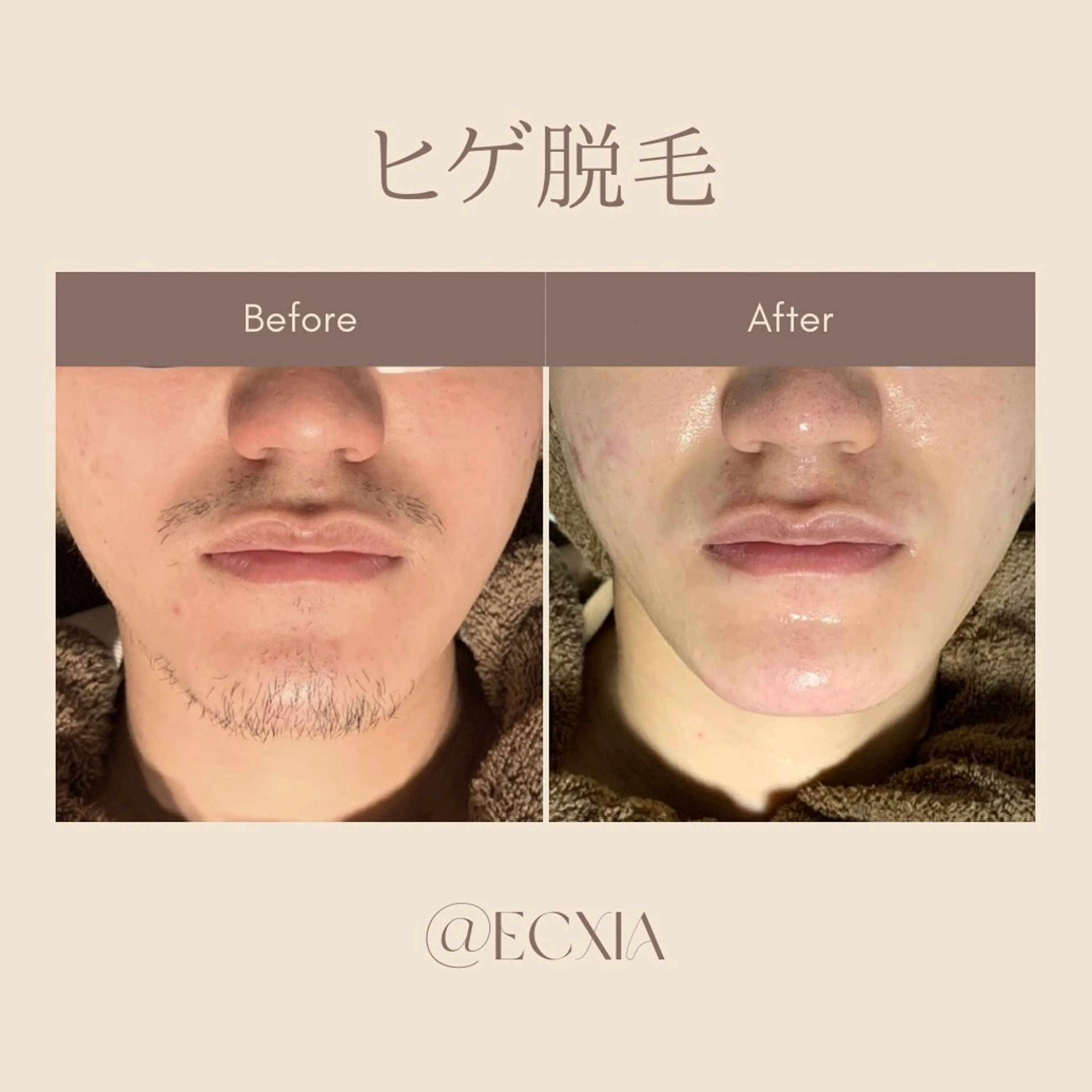 メンズ メンズ脱毛サロン ECXIA 博多のエステ・リラクイメージ