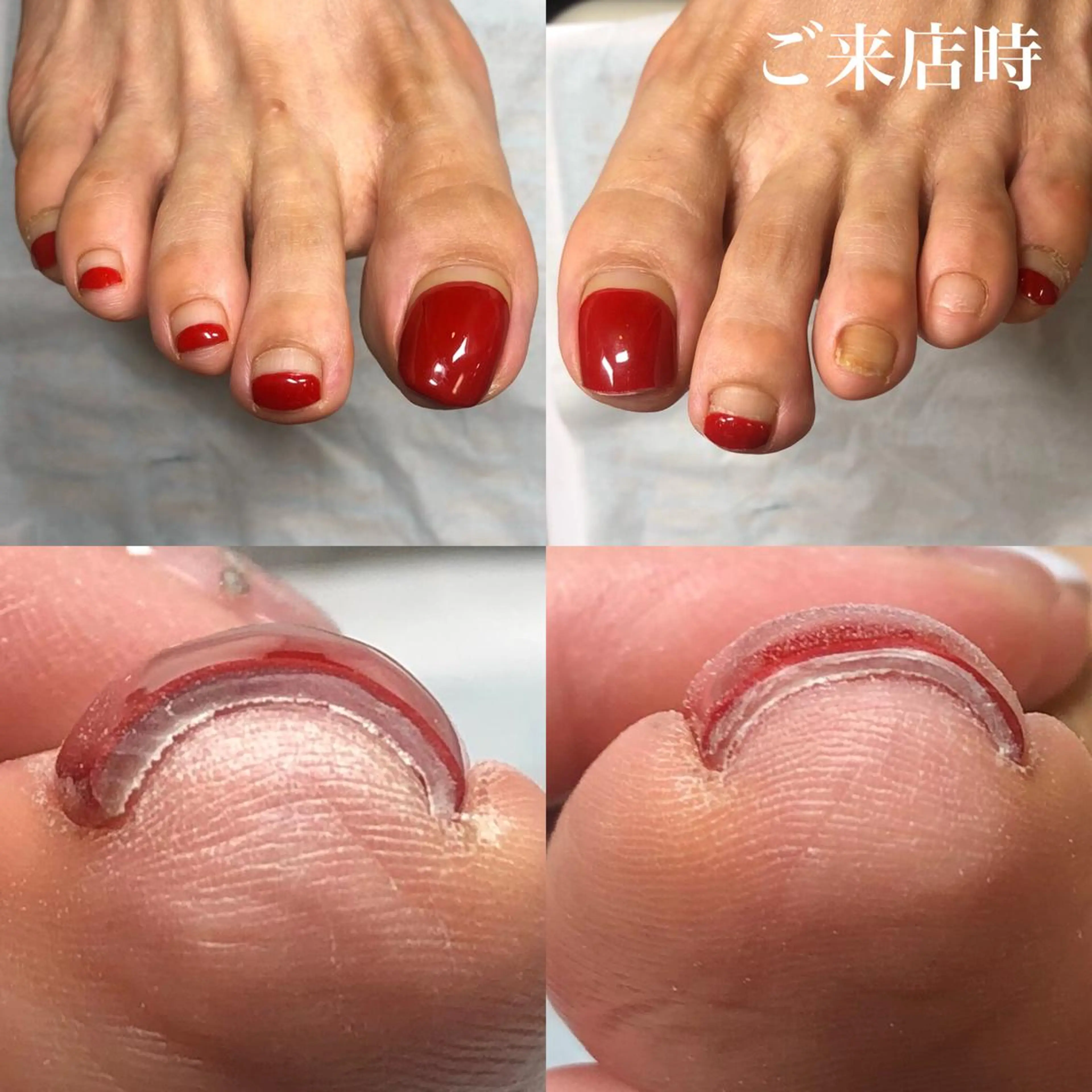 ネイル フットネイル .Nails Mio 赤羽西ネイルサロンのネイルデザイン