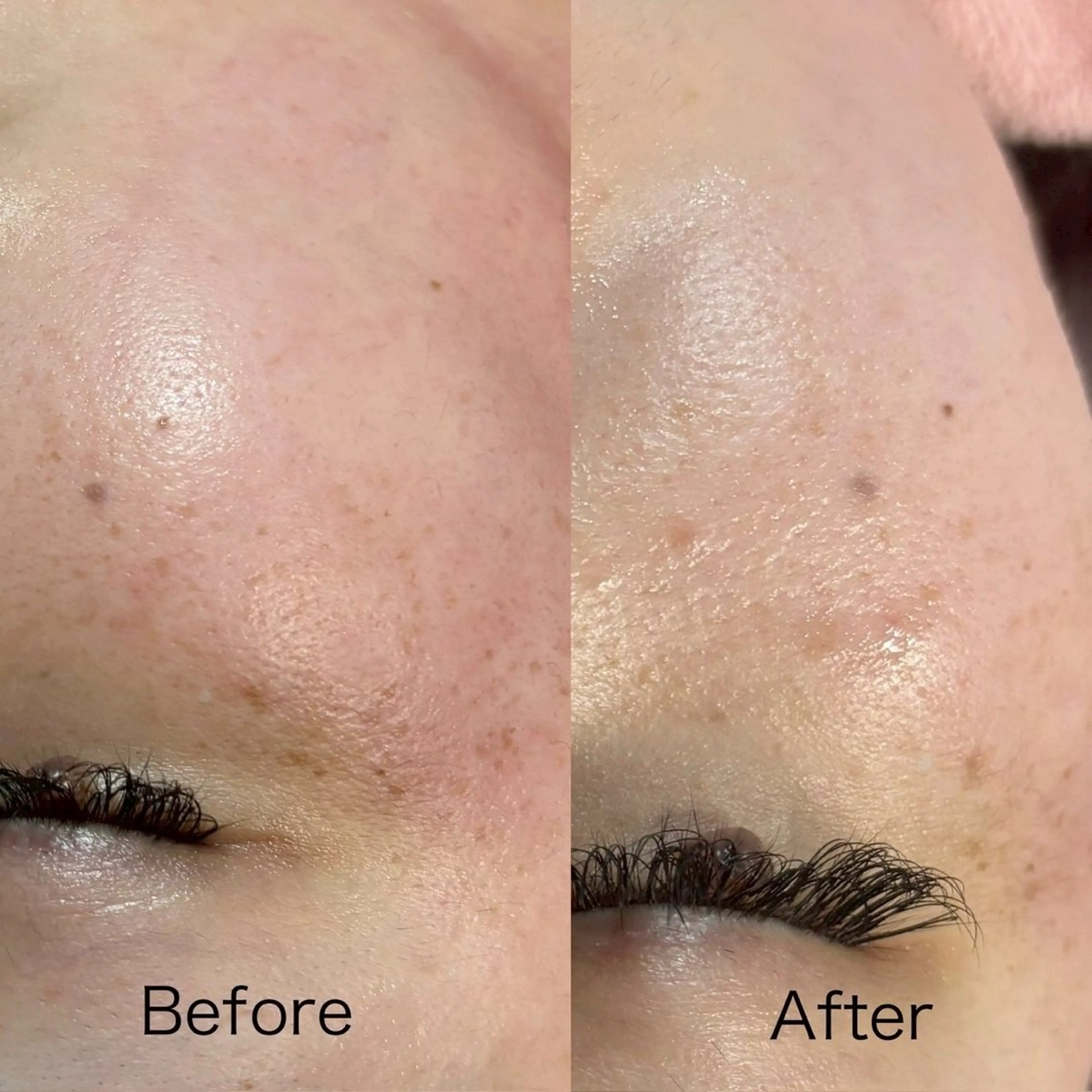 emma MINORIのエステ・リラクイメージ