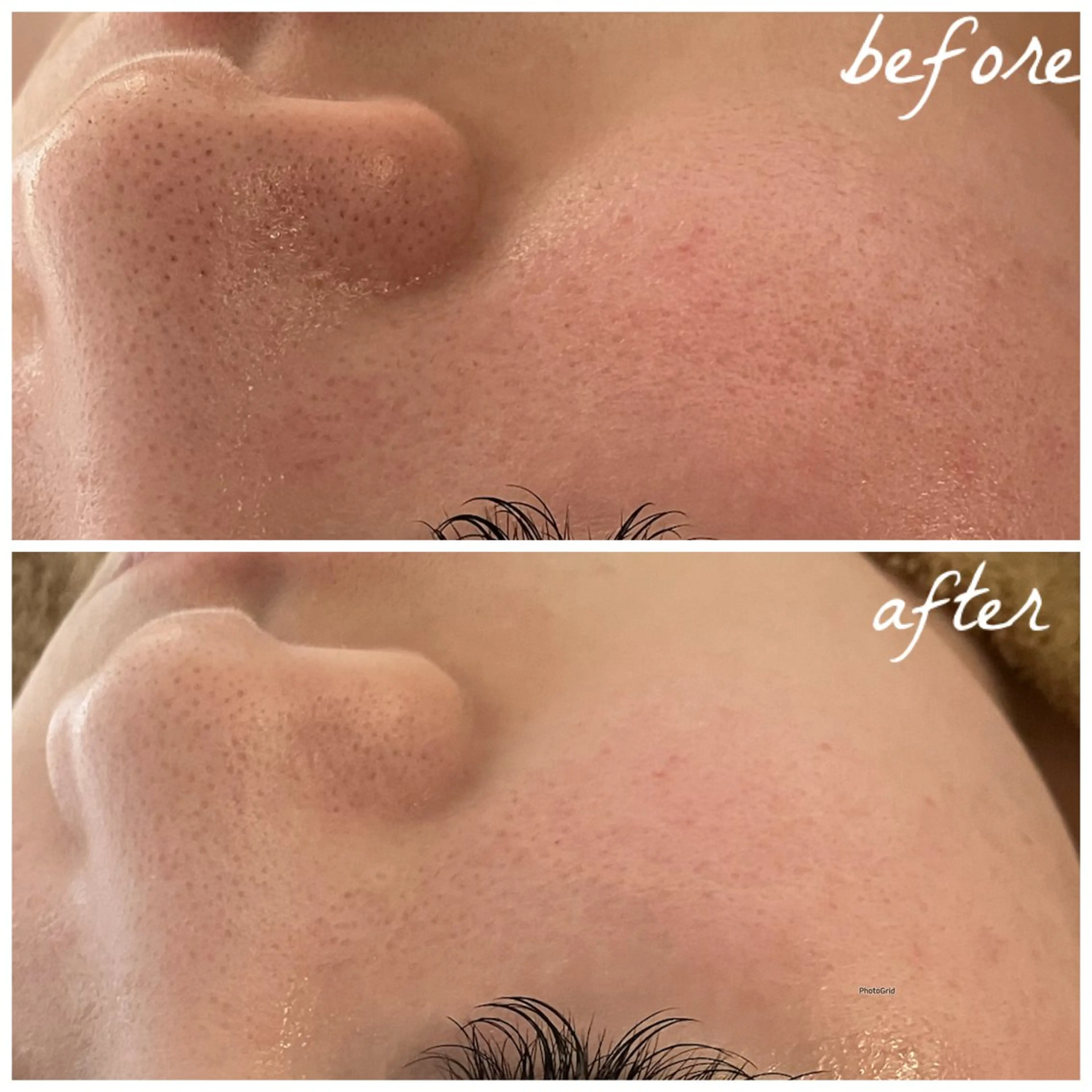 メンズ エステ メナード岐阜茜部 杉浦のエステ・リラクイメージ