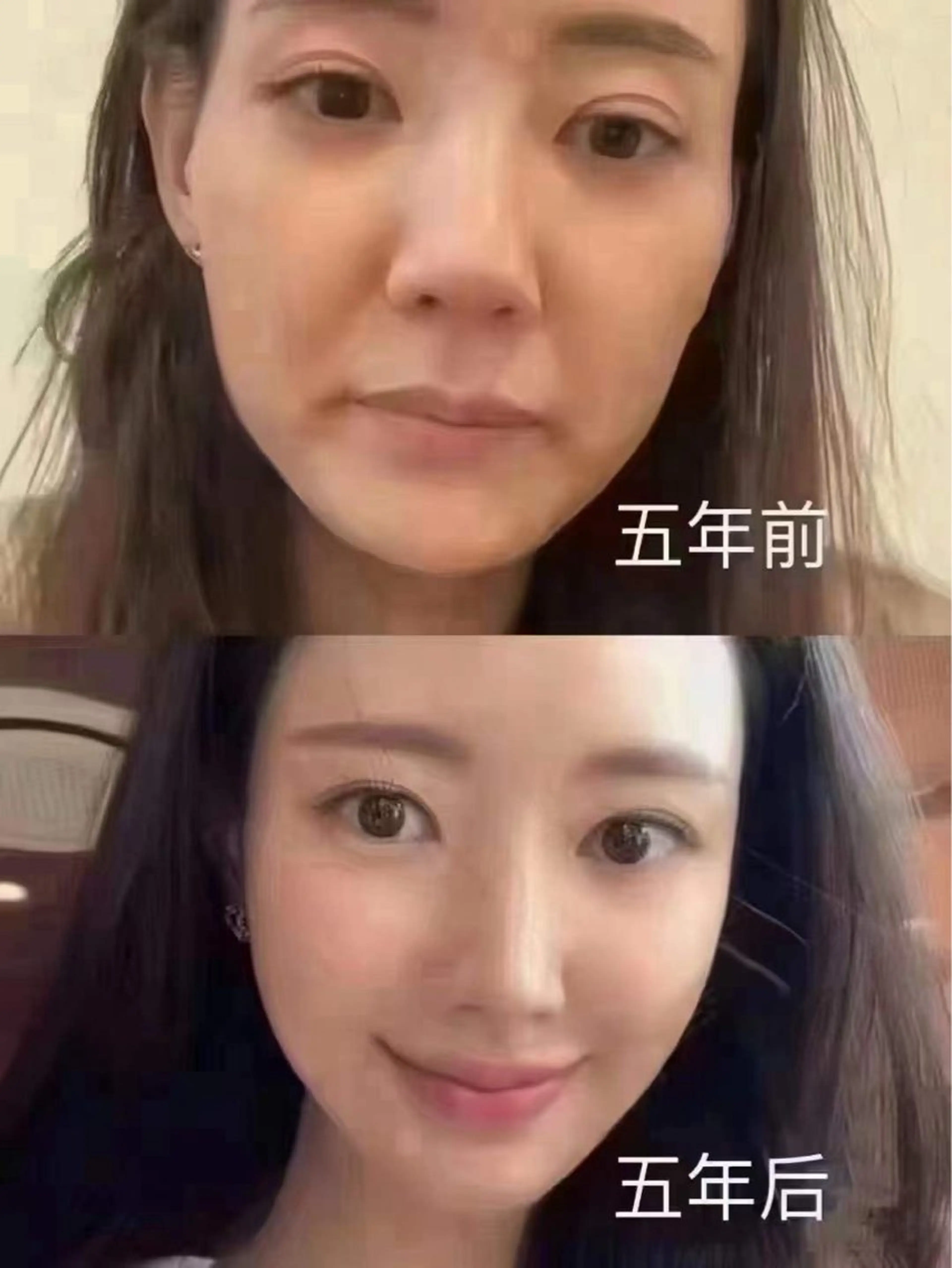 ネイル ブライダルネイル ホワイト エステ aliaハーブ水光店 エステティシャン募集のエステ・リラクイメージ