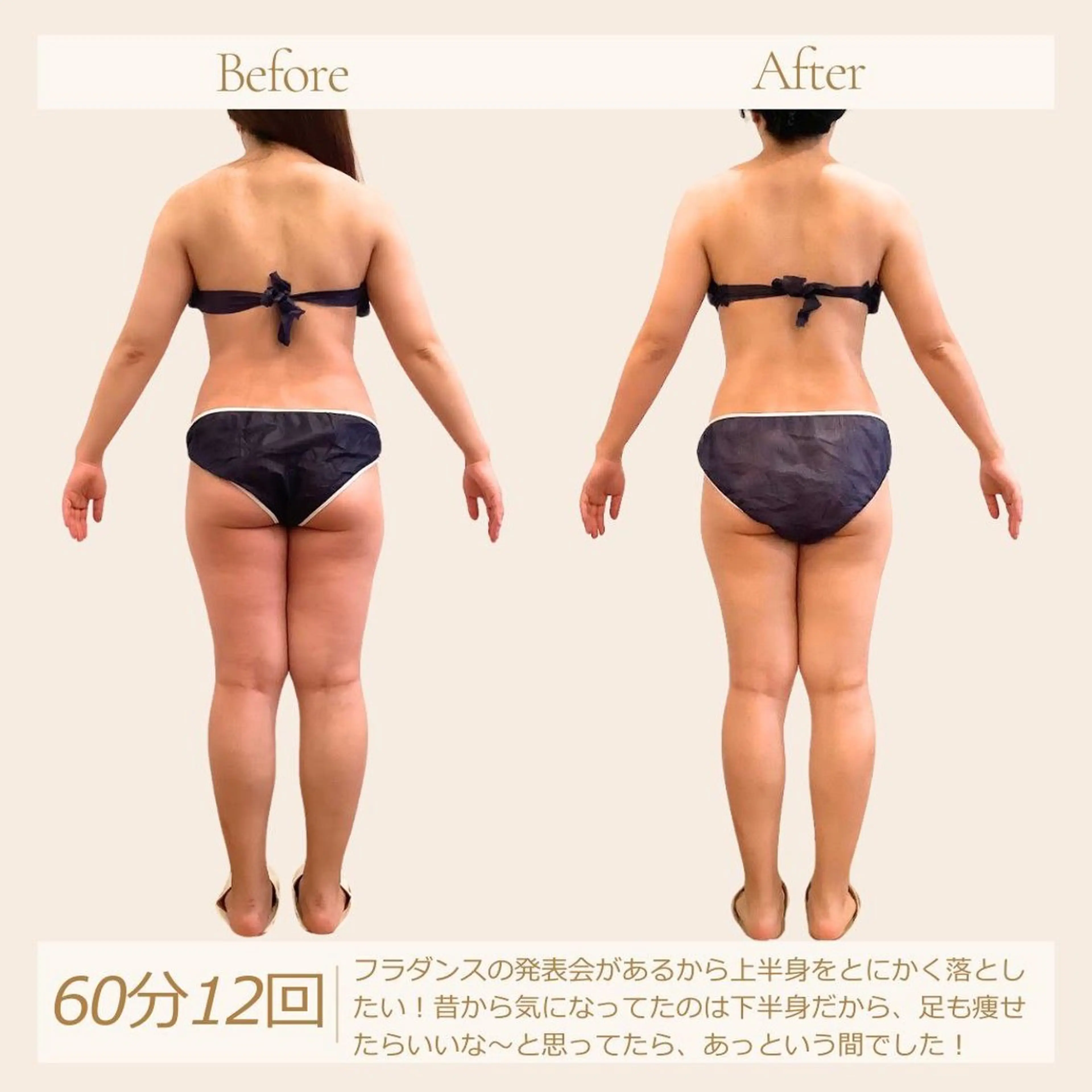 エステ リラク むくみ専門痩身 マクイエステティックのエステ・リラクイメージ