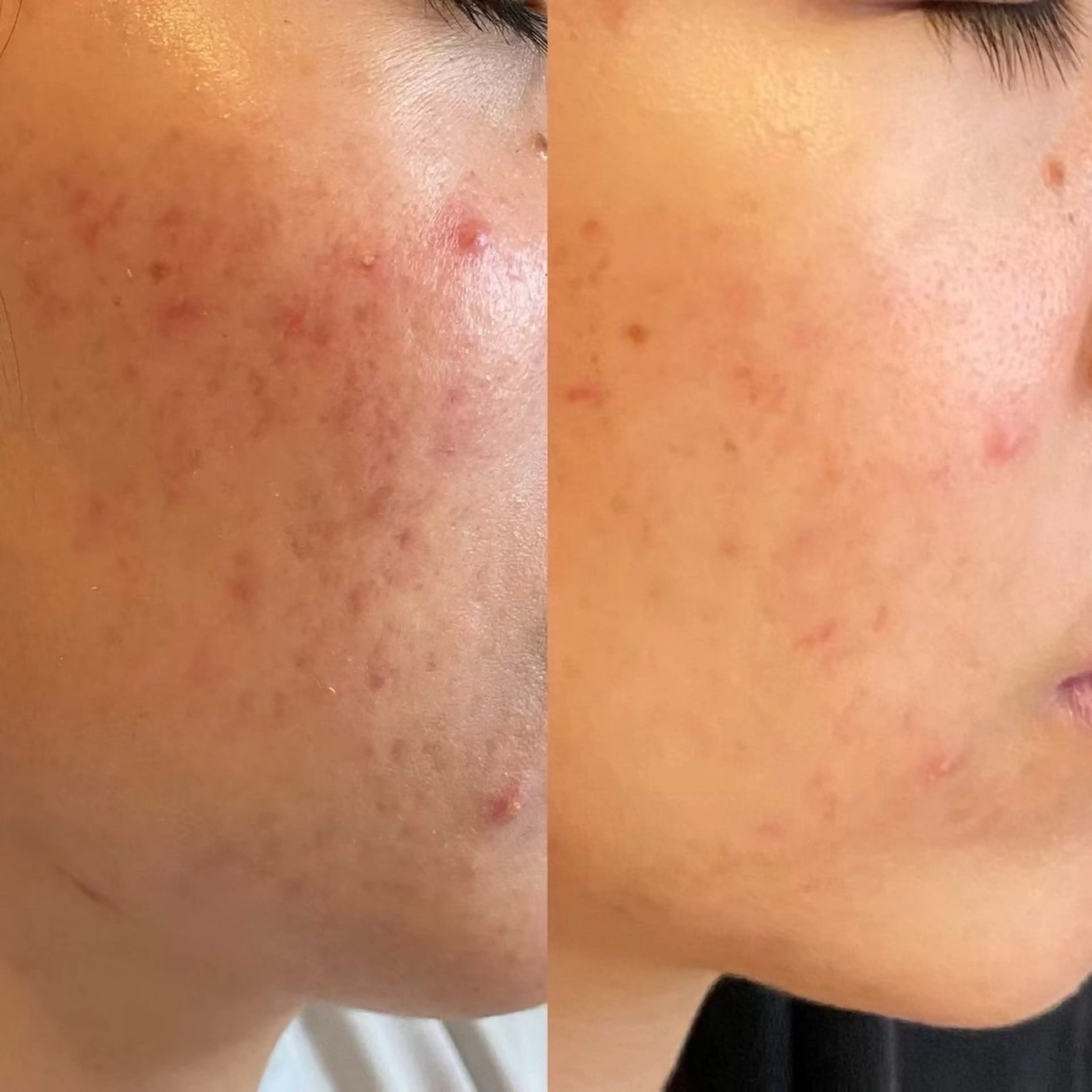 エステ 石川 彩花のエステ・リラクイメージ